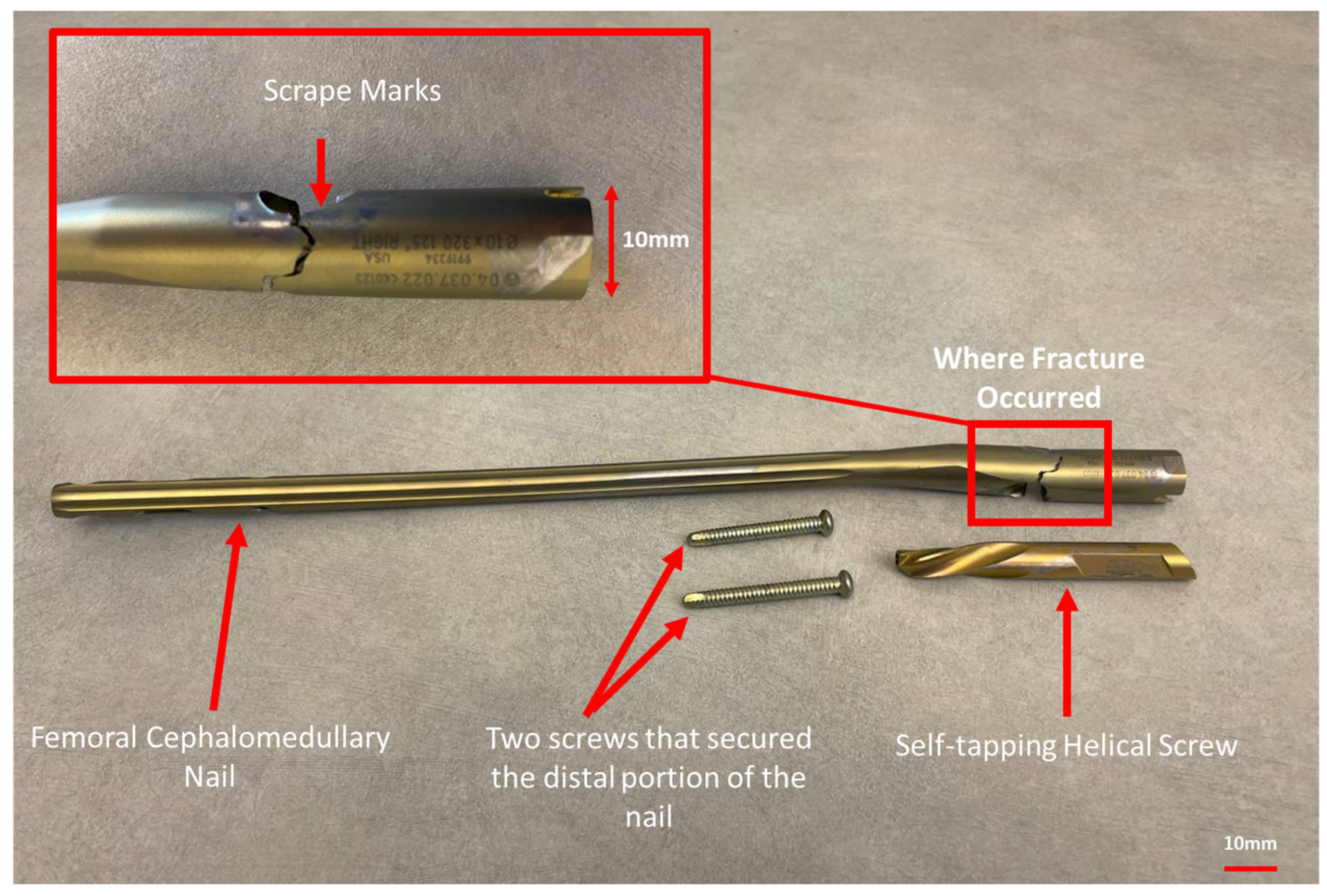 Metals 13 00506 g002 Metals 13 00506 g002