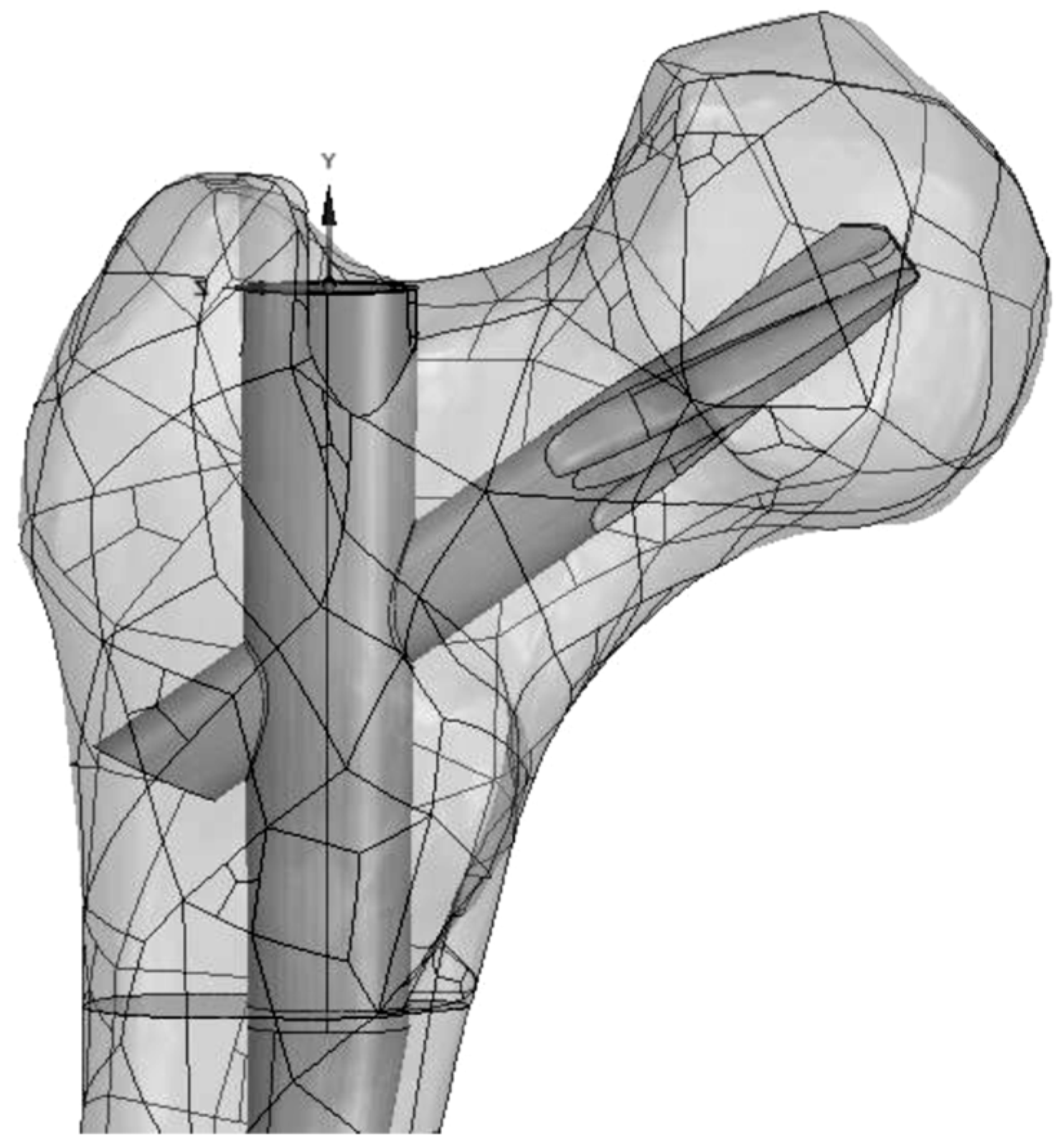 Metals 13 00506 g004 Metals 13 00506 g004