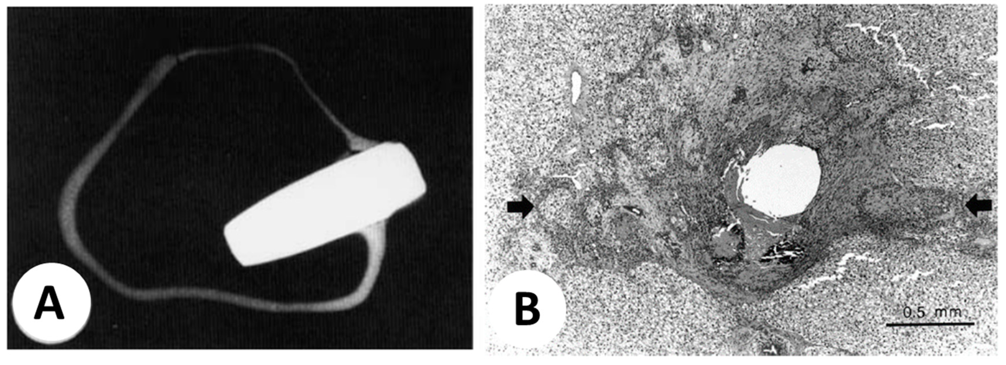 Metals 13 00949 g008 Metals 13 00949 g008