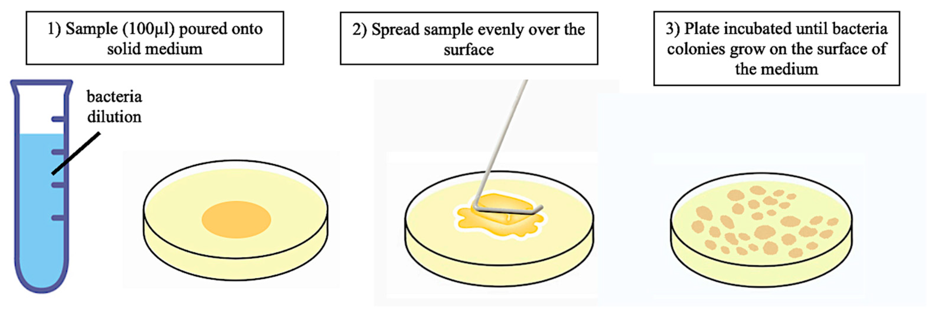 Metals 13 01974 g005