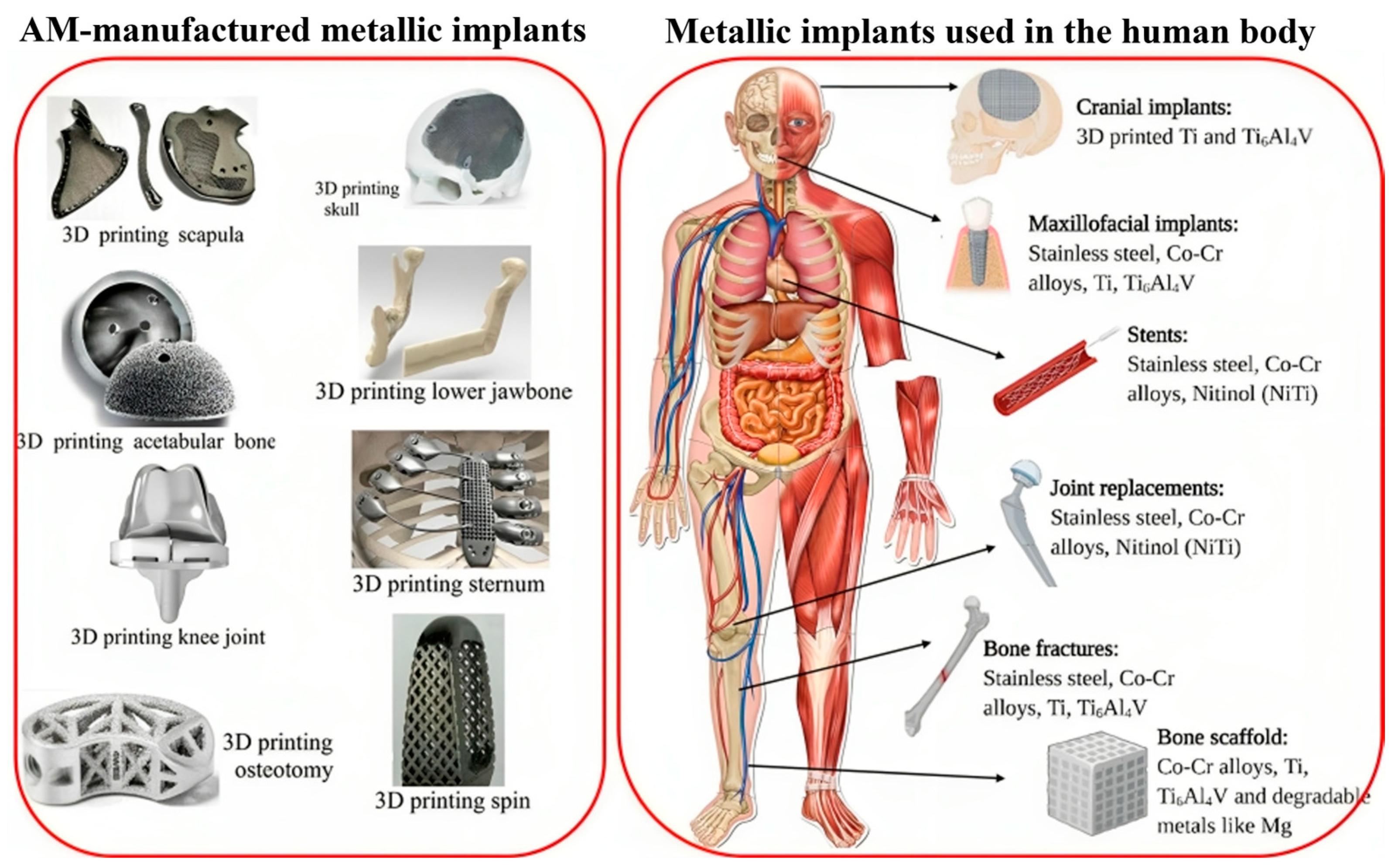 Metals 14 00096 g003