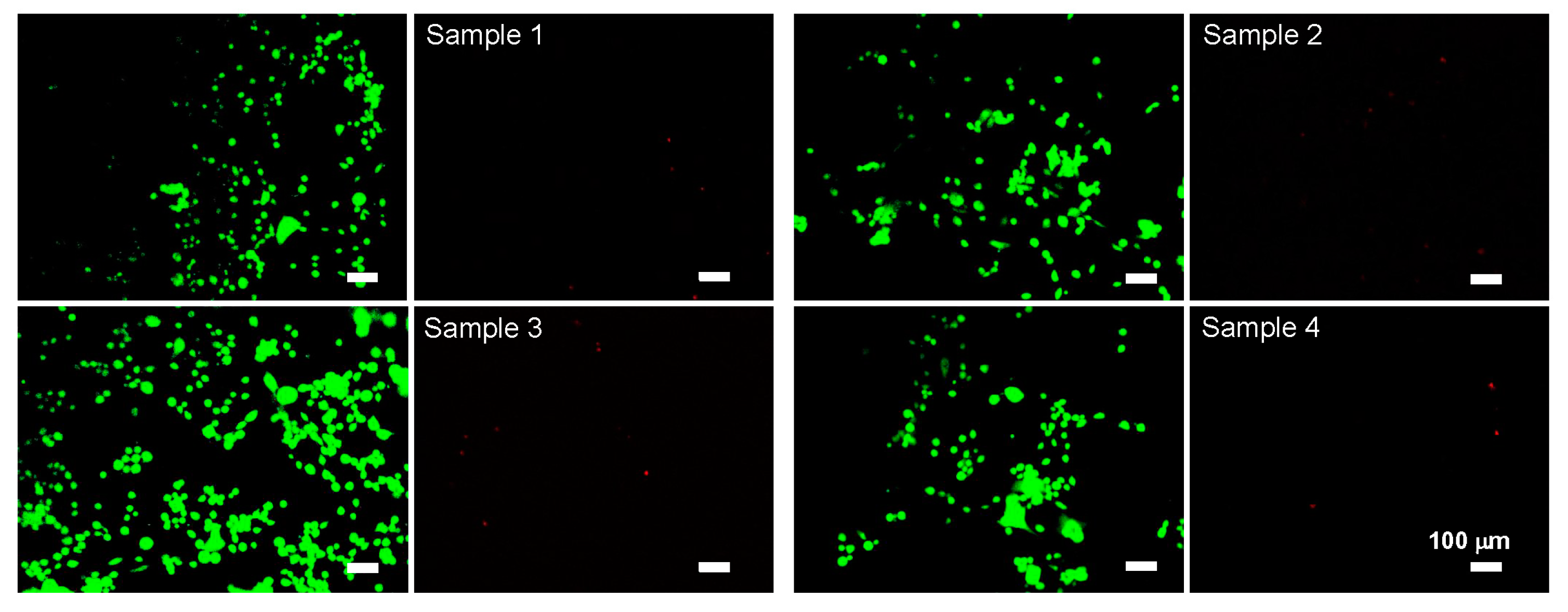 Metals 14 00122 g009