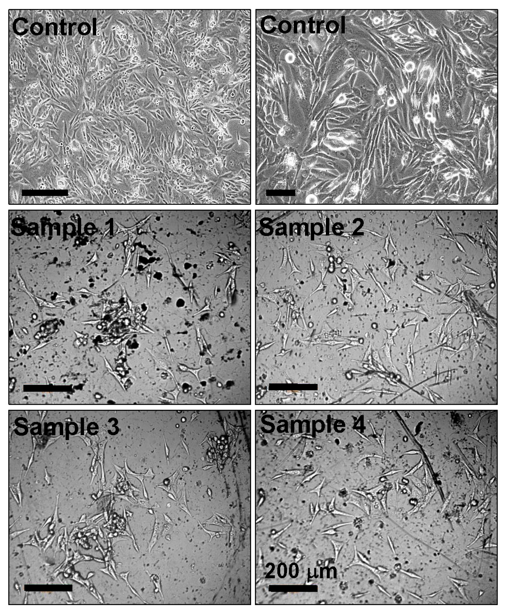 Metals 14 00122 g011
