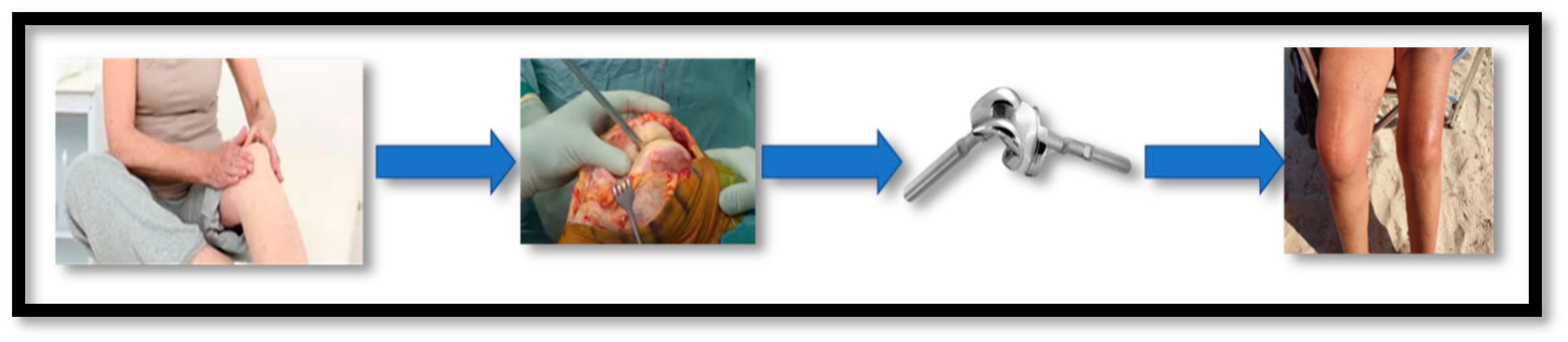 Metals 14 01081 g028