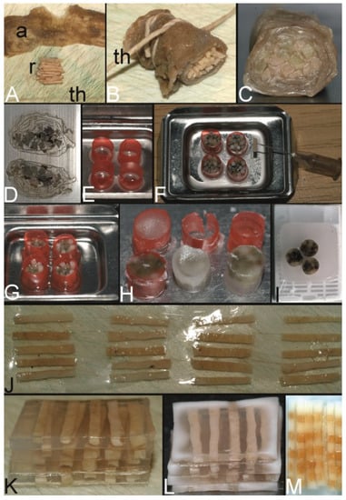 Stepwise construction of a tissue microarray. (A) A paraffin wax core