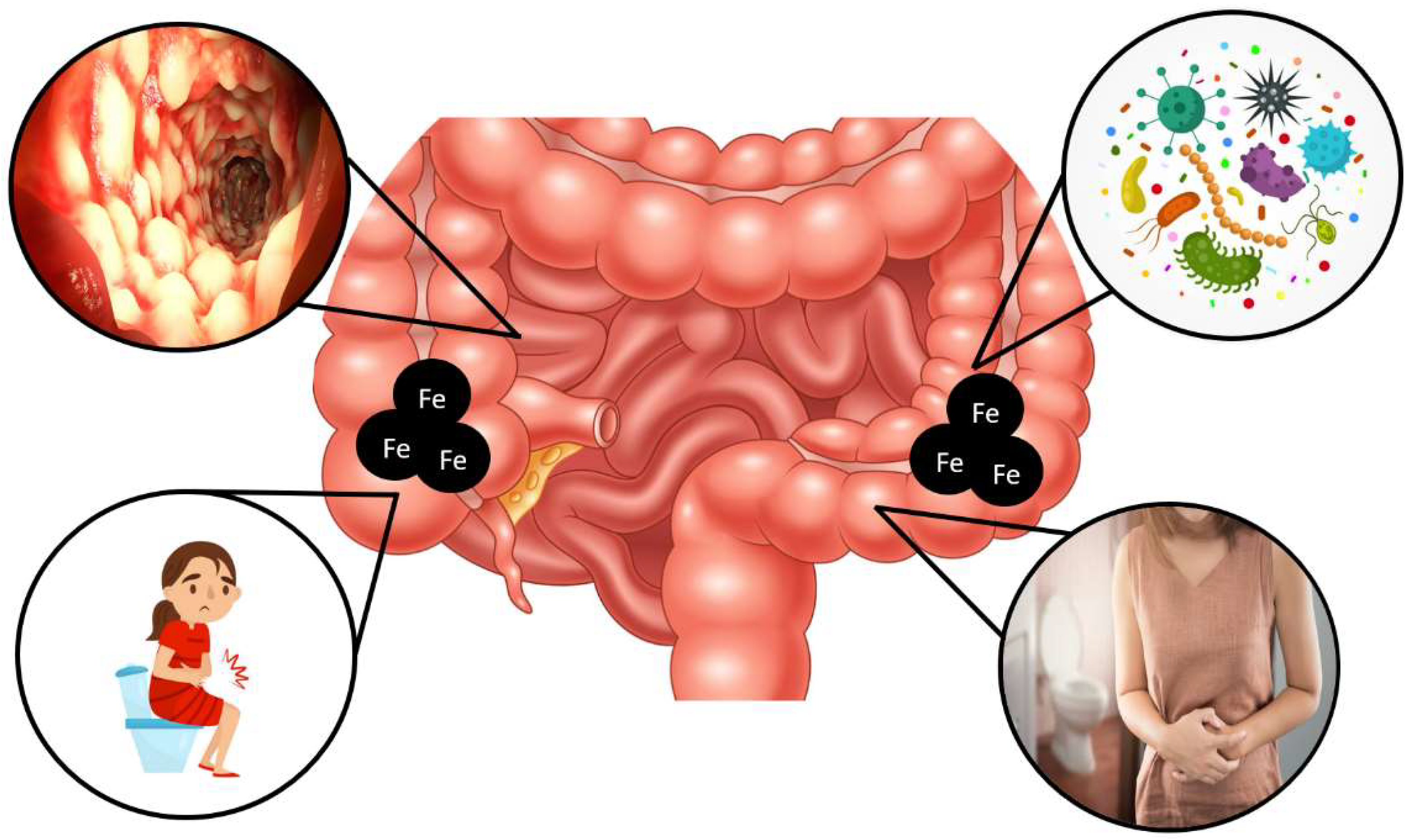 Microbiology Research | Free Full-Text | Oral Iron  Supplementation—Gastrointestinal Side Effects and the Impact on the Gut  Microbiota