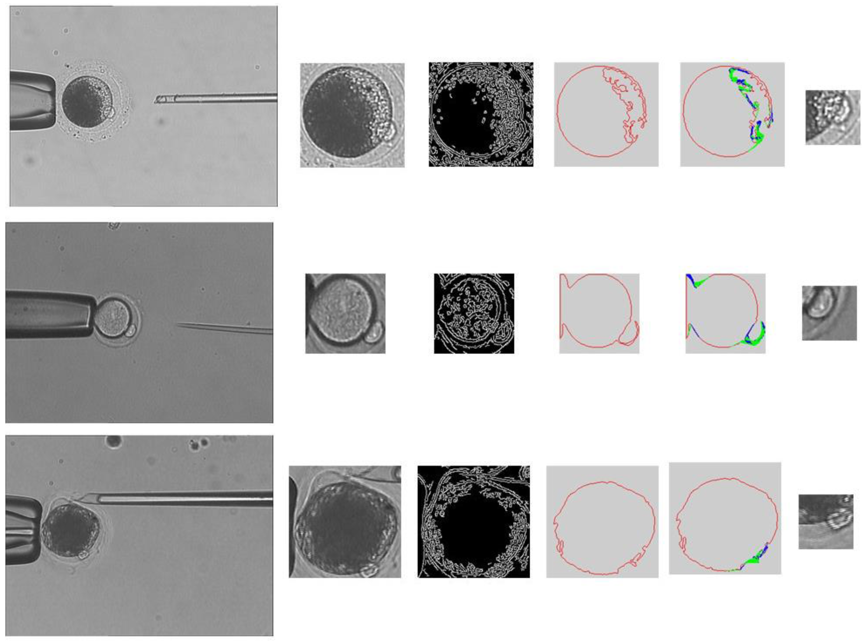 Micromachines | Free Full-Text | Oocytes Polar Body Detection for Automatic  Enucleation