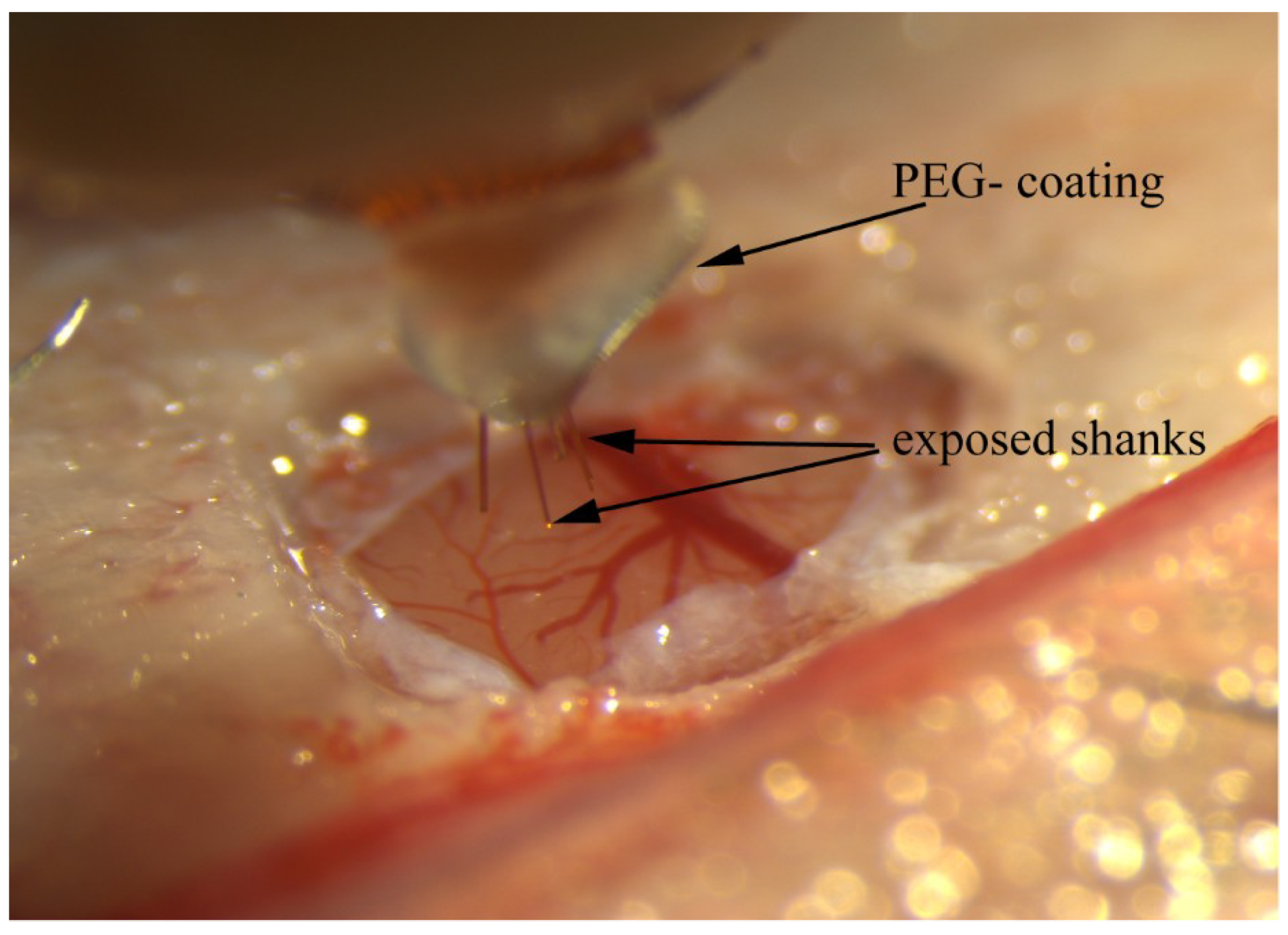 Micromachines 09 00480 g003
