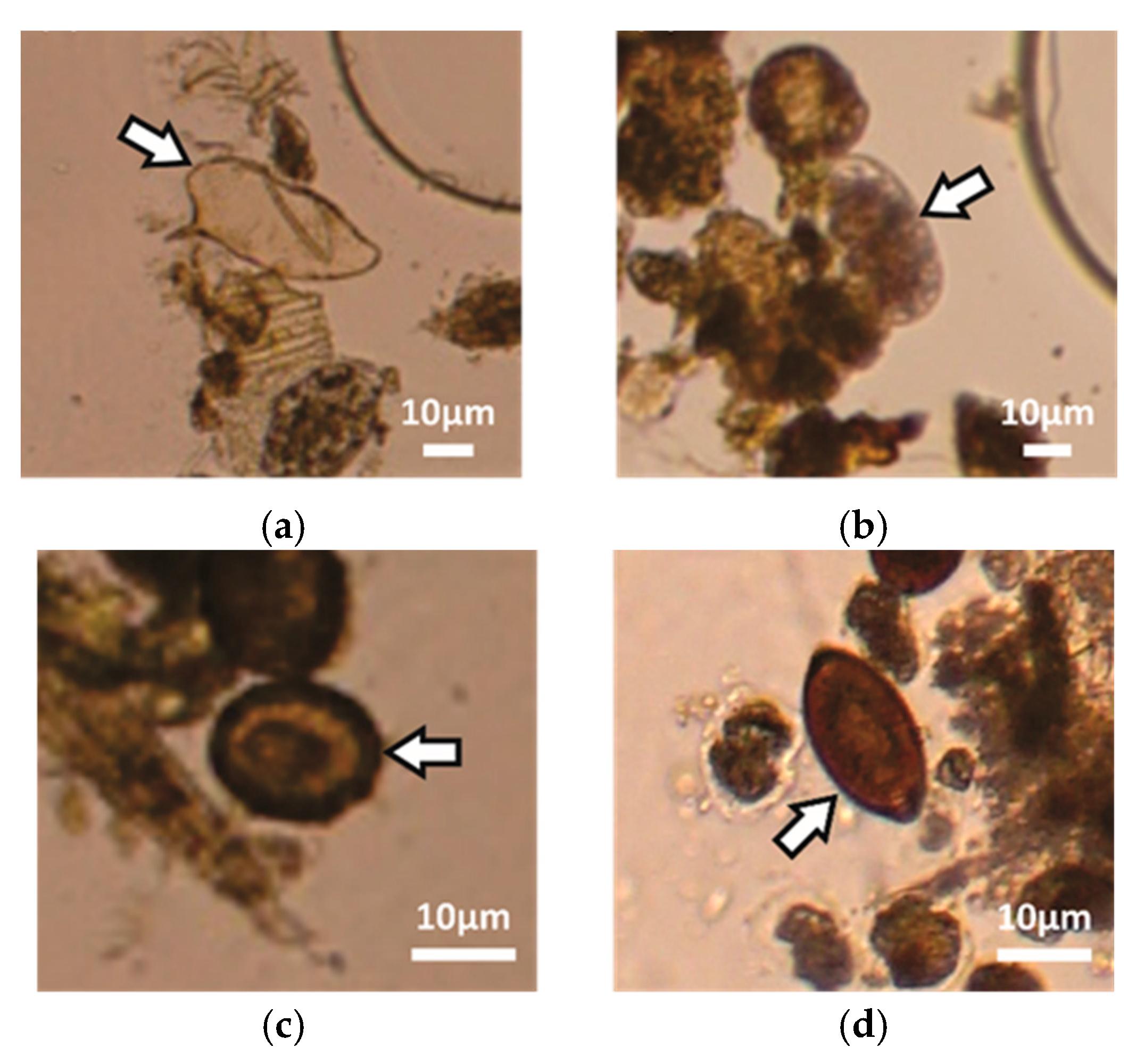 Micromachines Free Full Text Development Of A Lab On A Disk Platform With Digital Imaging For Identification And Counting Of Parasite Eggs In Human And Animal Stool Html