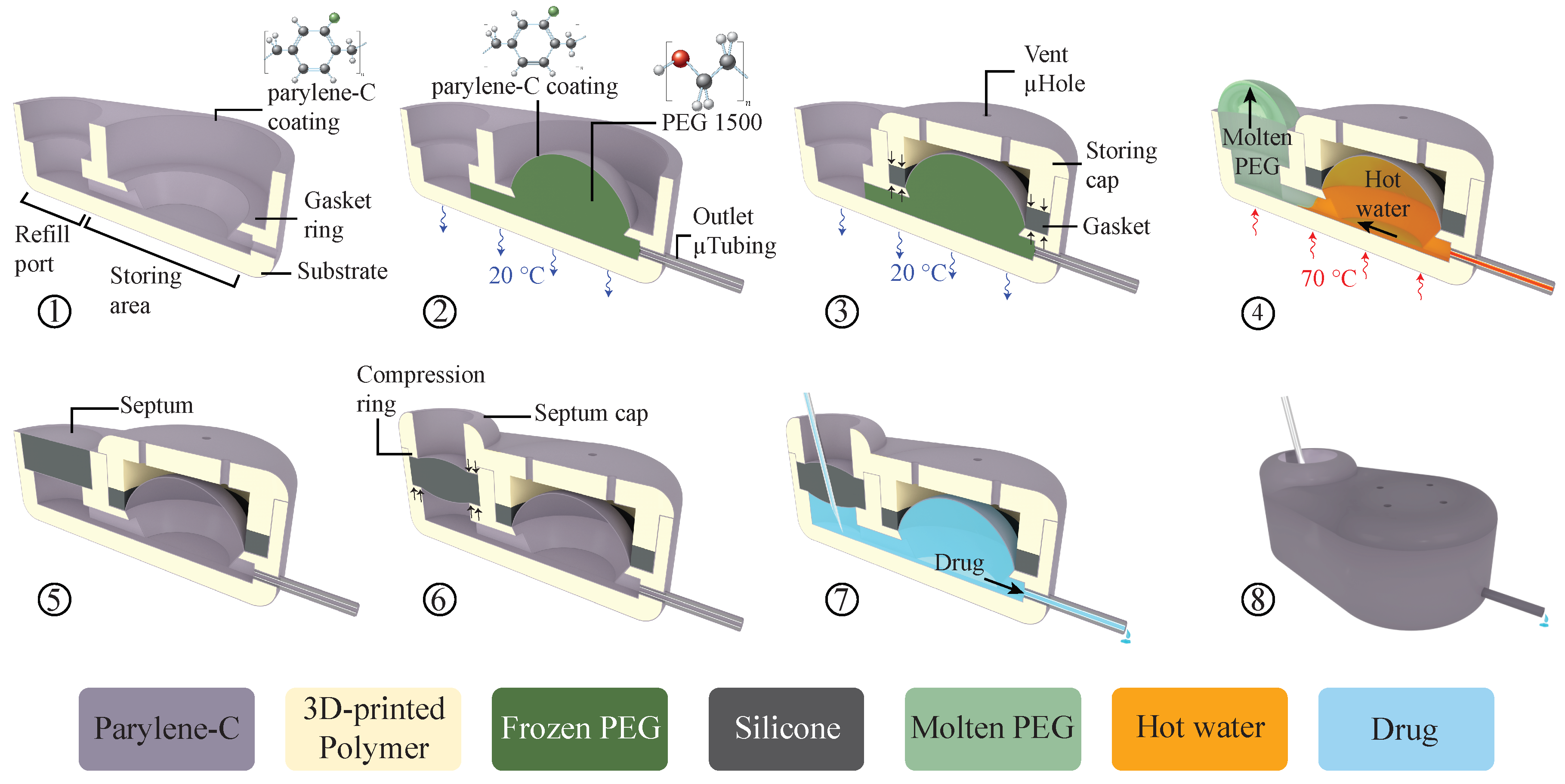 Prometra micro-infusion device used to deliver meds directly to