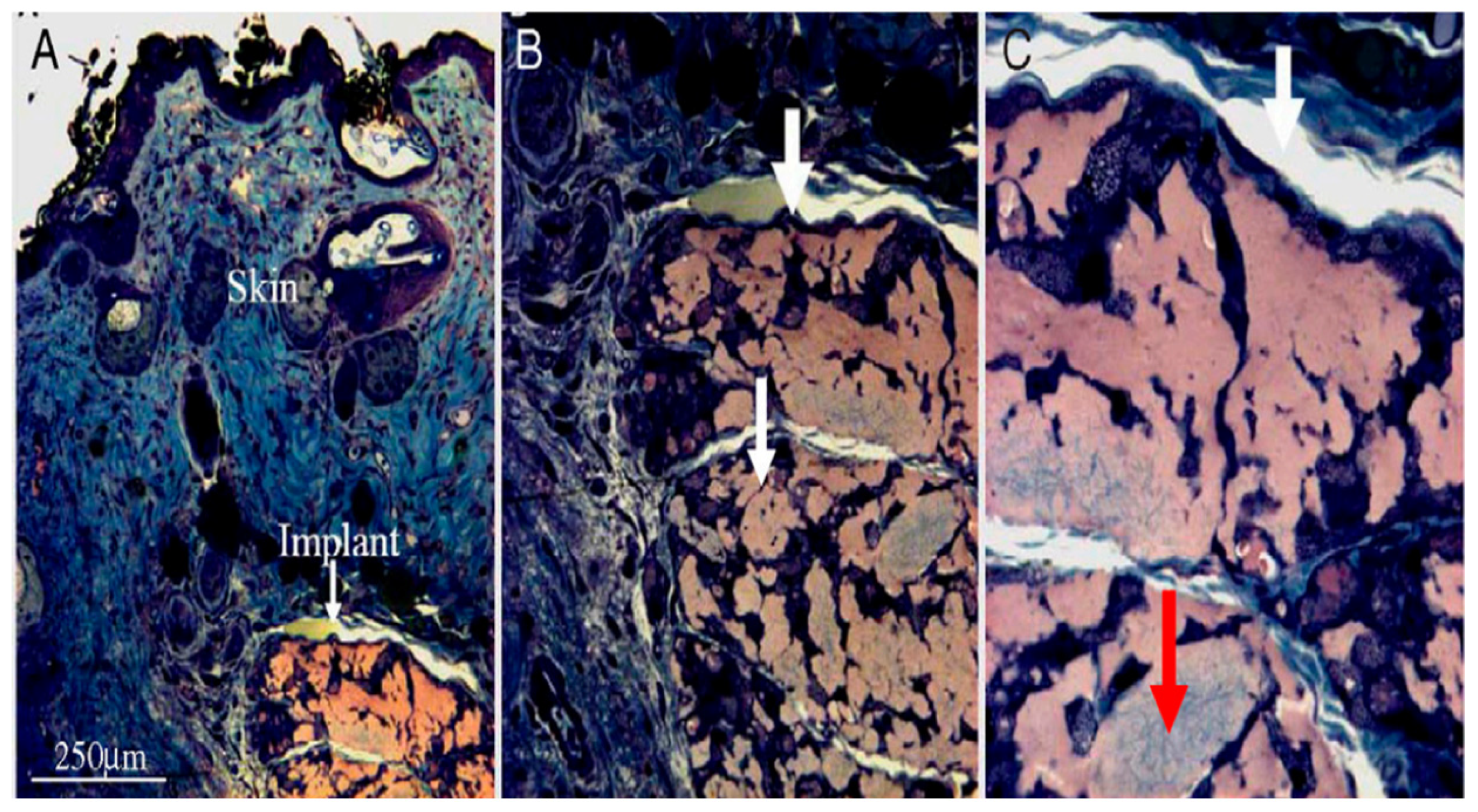 Micromachines 11 00797 g011