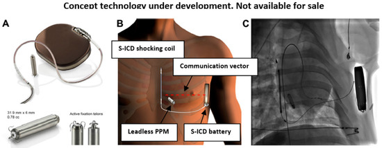  IMPLANTED DEFIBRILLATOR Sport/Slim Reversible