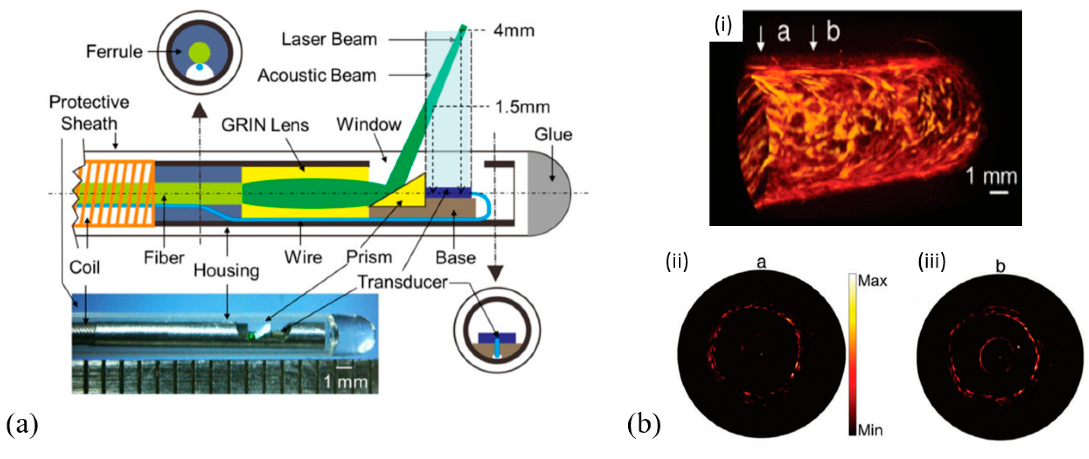 Micromachines | Free Full-Text | MEMS Ultrasound Transducers for Endoscopic  Photoacoustic Imaging Applications