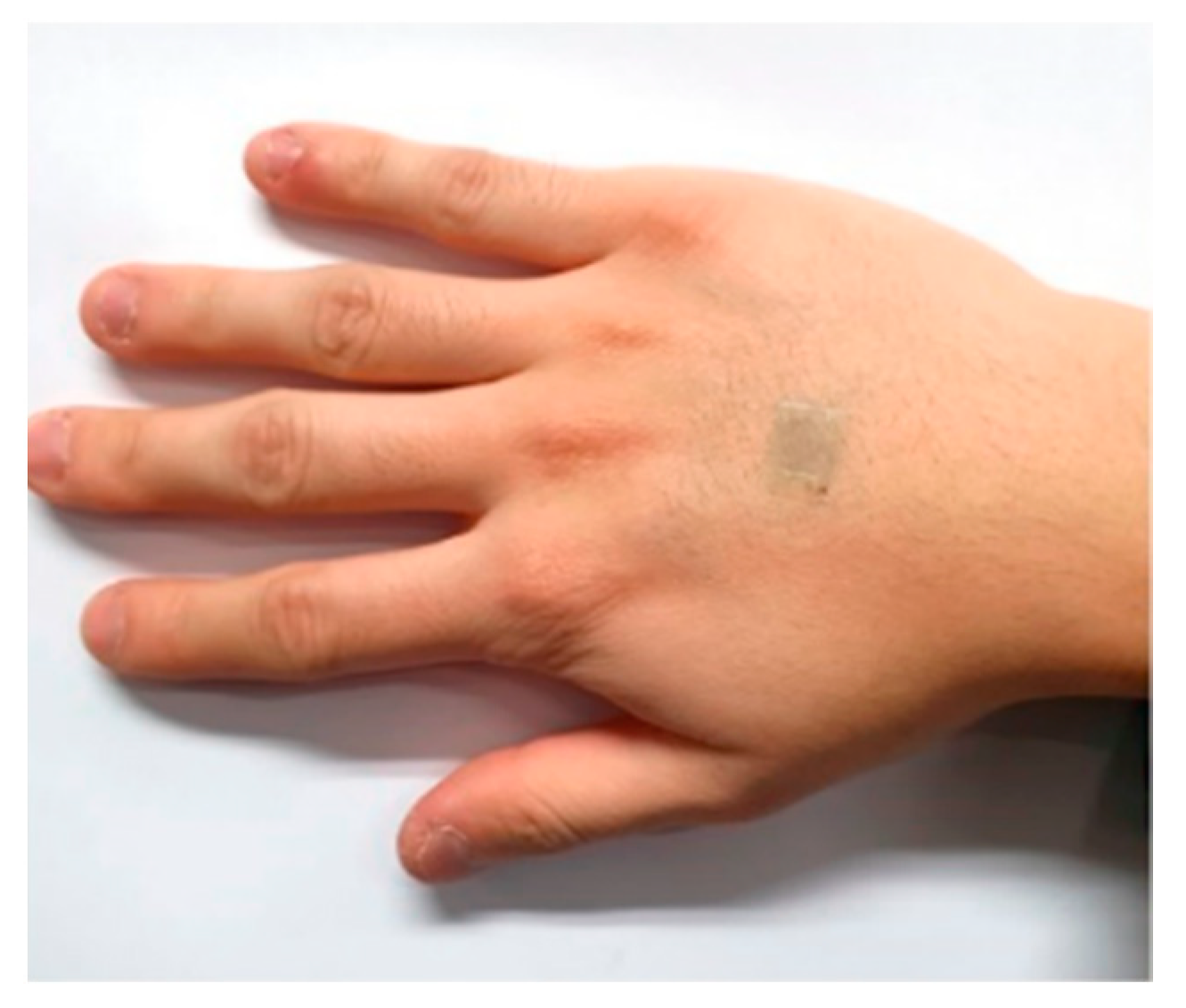 Micromachines 12 00064 g011