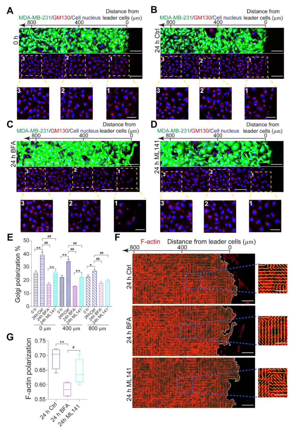 Micromachines 12 00112 g004