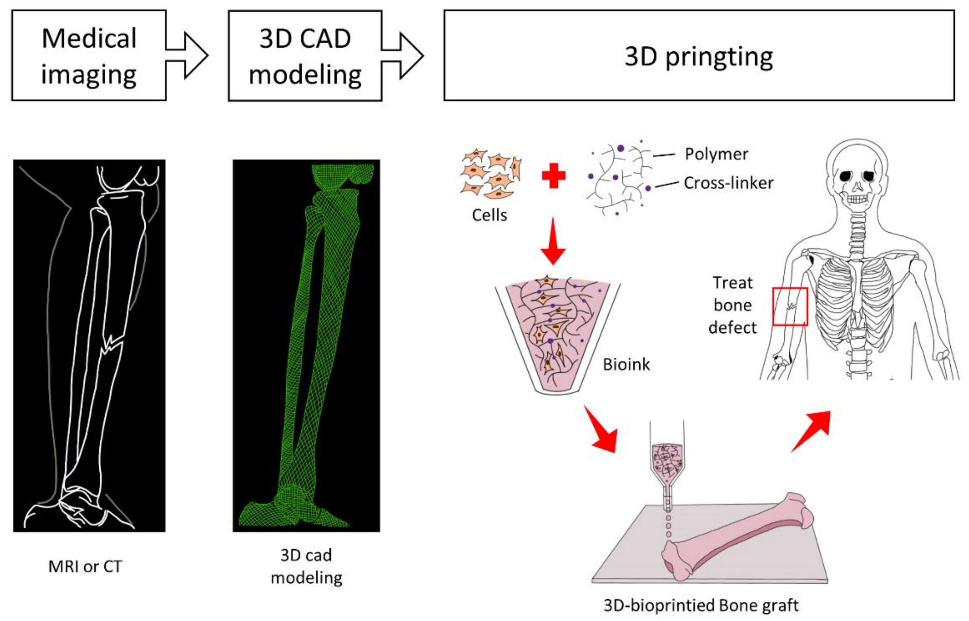 Micromachines Free Full Text 3d Bioprinting Strategies Based On In Situ Bone Healing Mechanism For Vascularized Bone Tissue Engineering Html