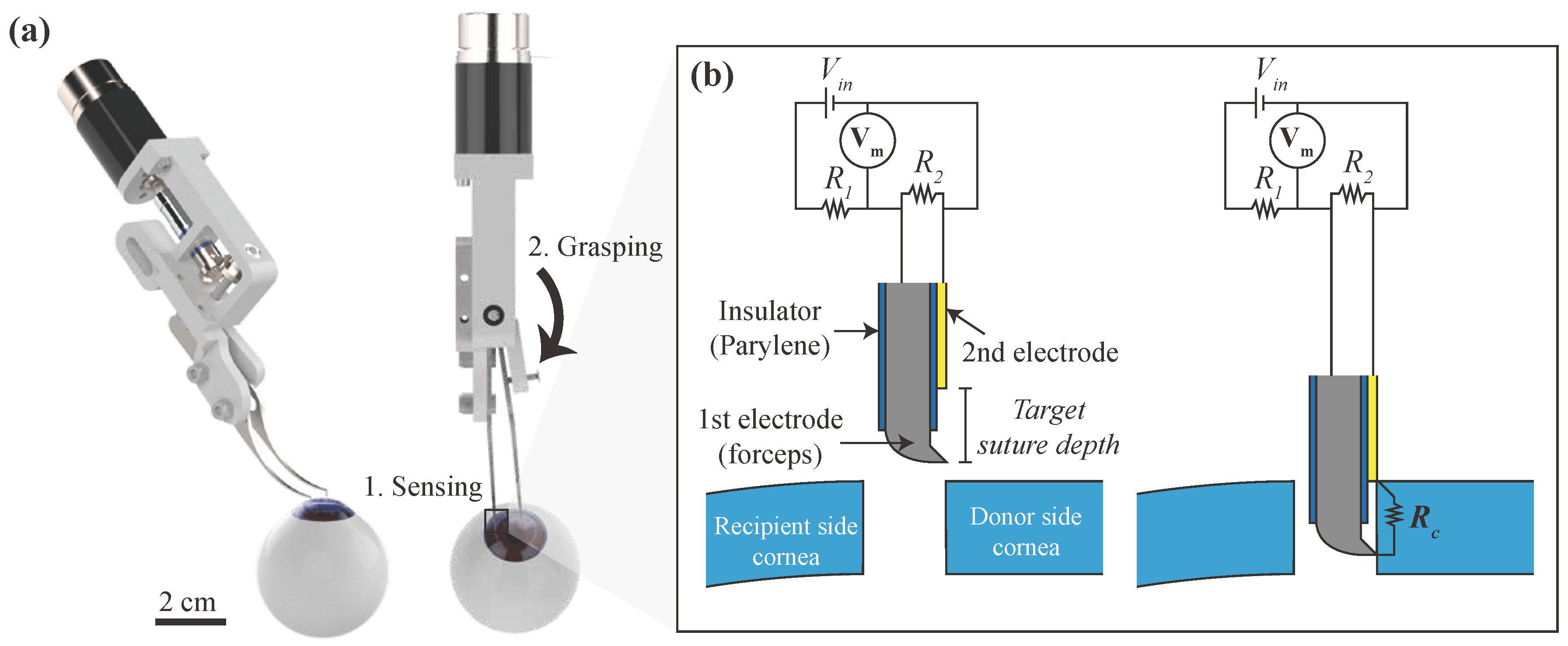 Micromachines | Free Full-Text | Sensor-Embedded Automatic Grasping Forceps  for Precise Corneal Suture in Penetrating Keratoplasty