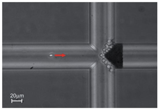 Acoustic lens generates tunable 'sound bullets' for ultrasound applications