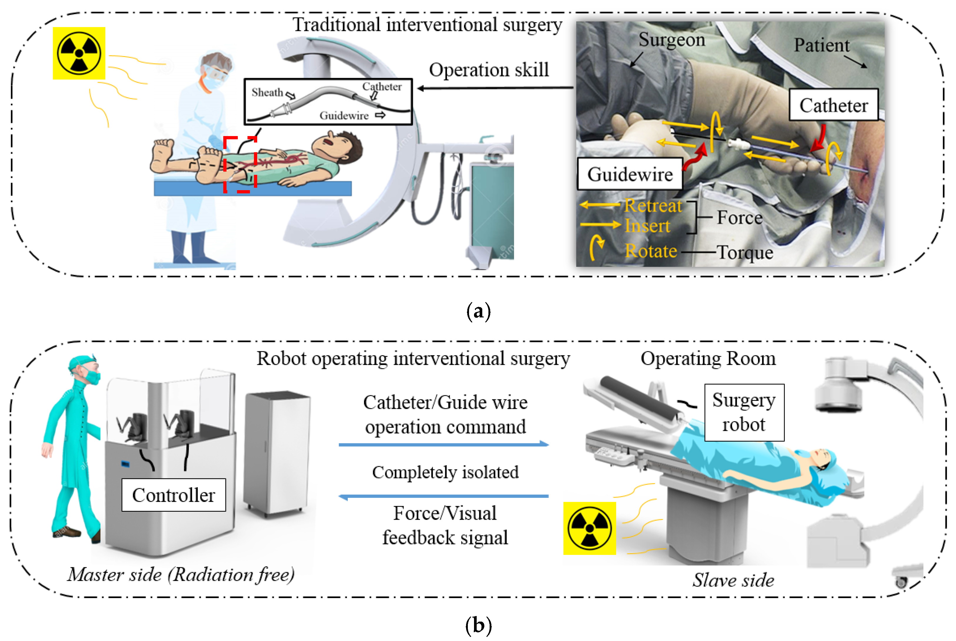 Micromachines | Free Full-Text | An Isomorphic Interactive Device for the  Interventional Surgical Robot after In Vivo Study