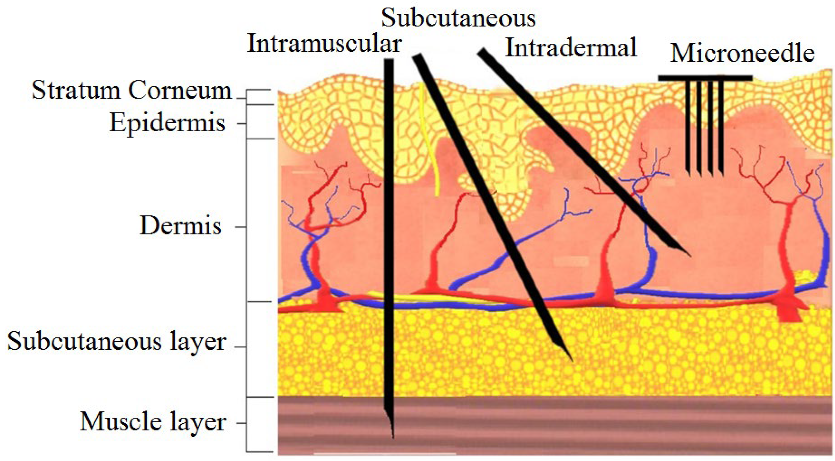Micromachines 13 00657 g001 Micromachines 13 00657 g001