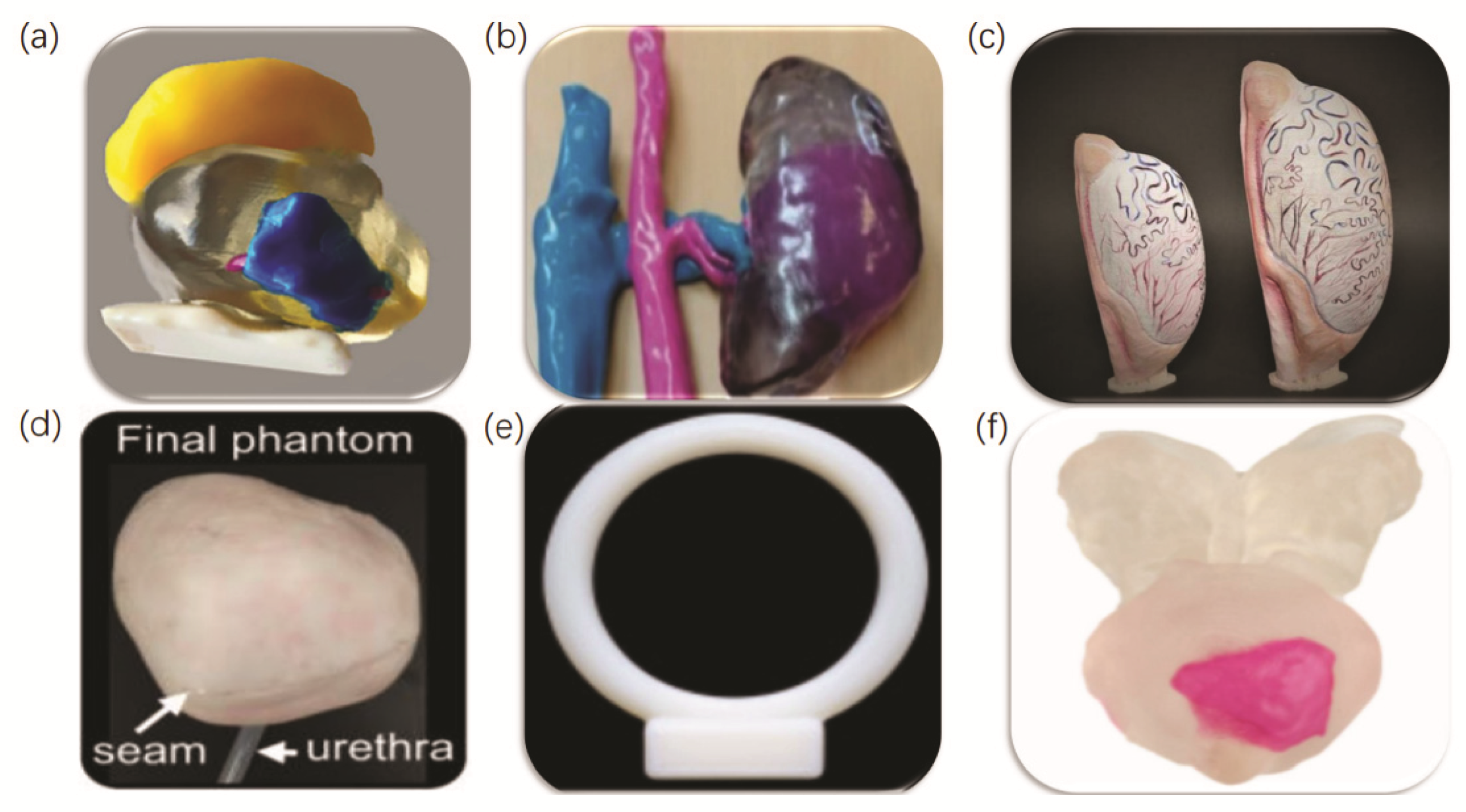 Micromachines | Free Full-Text | Application of 3D Bioprinting in