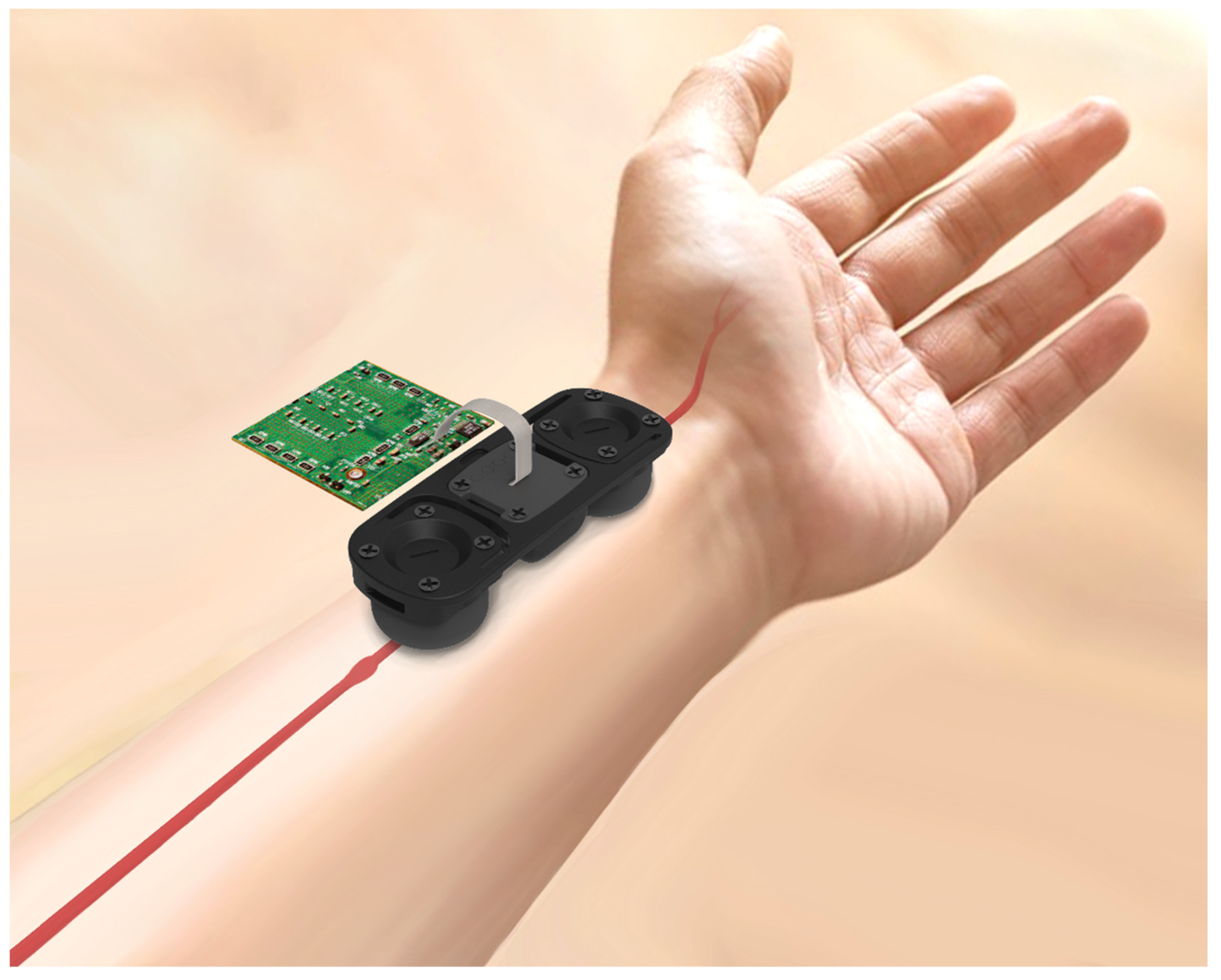 Micromachines | Free Full-Text | An Arterial Compliance Sensor for Cuffless  Blood Pressure Estimation Based on Piezoelectric and Optical Signals