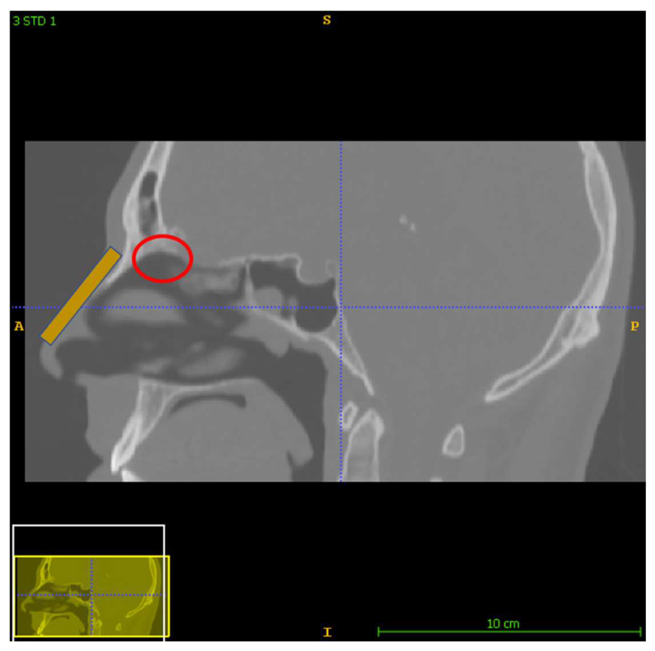 Micromachines 13 01816 g001 Micromachines 13 01816 g001