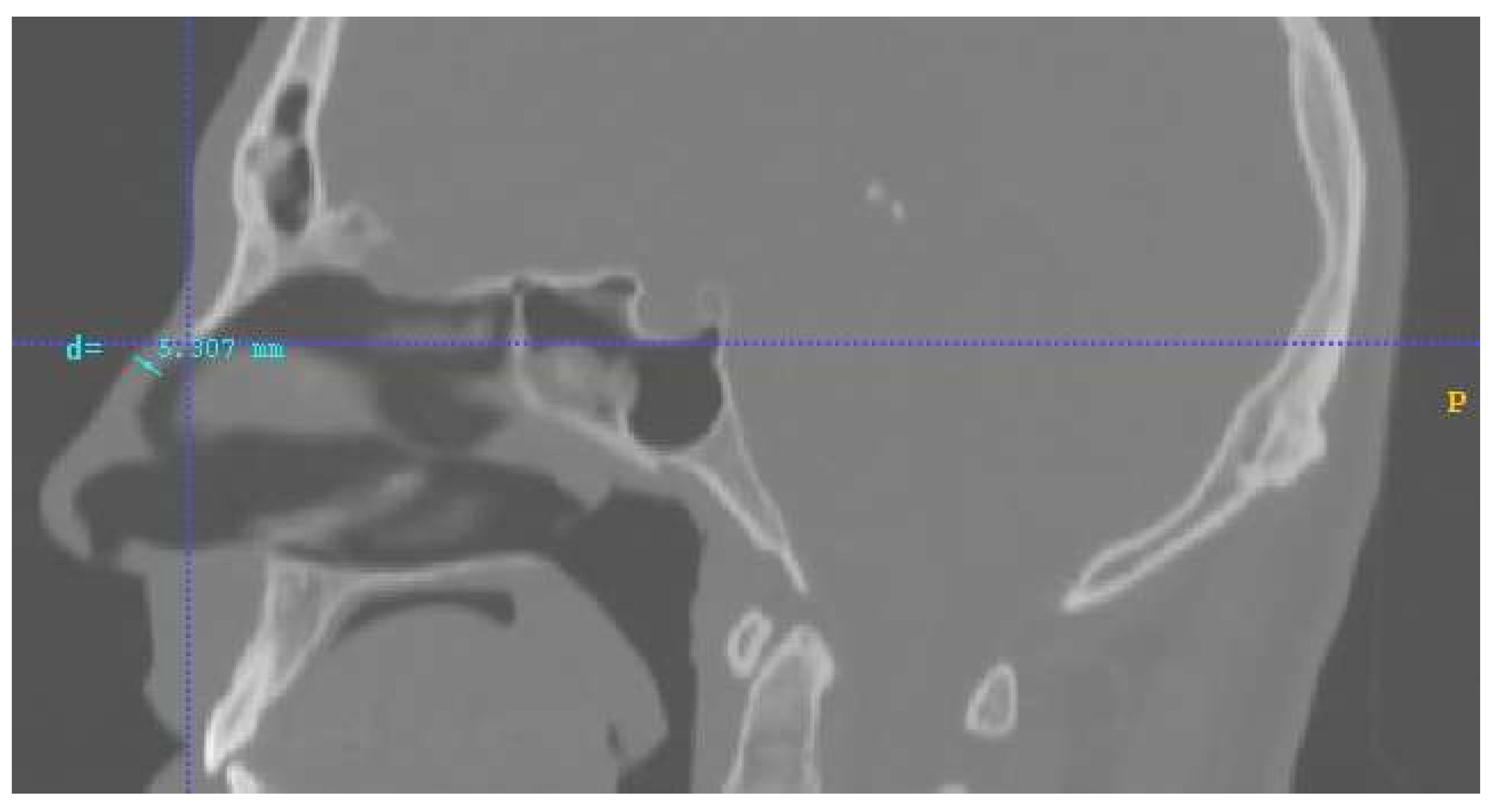 Micromachines 13 01816 g006 Micromachines 13 01816 g006