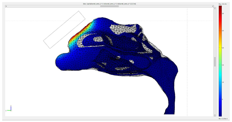 Micromachines 13 01816 i004 Micromachines 13 01816 i004