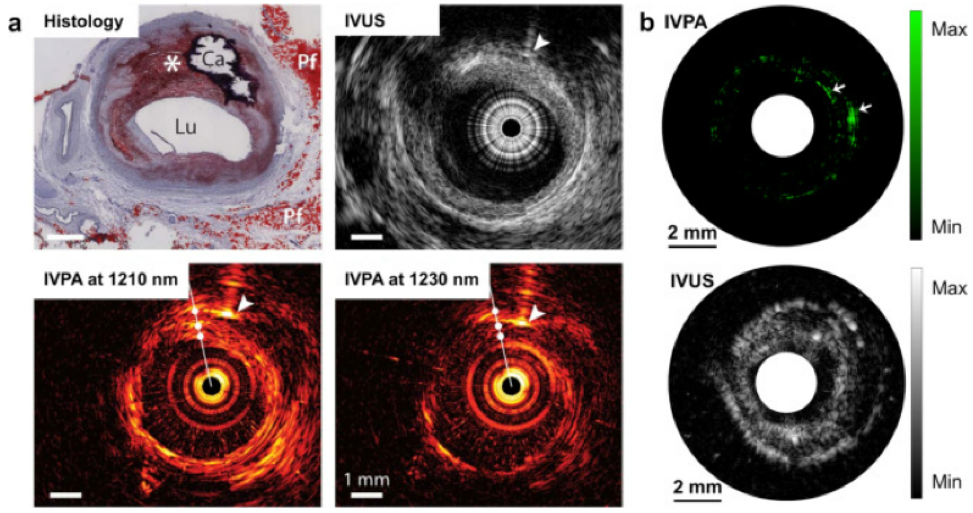Micromachines 13 01900 g006