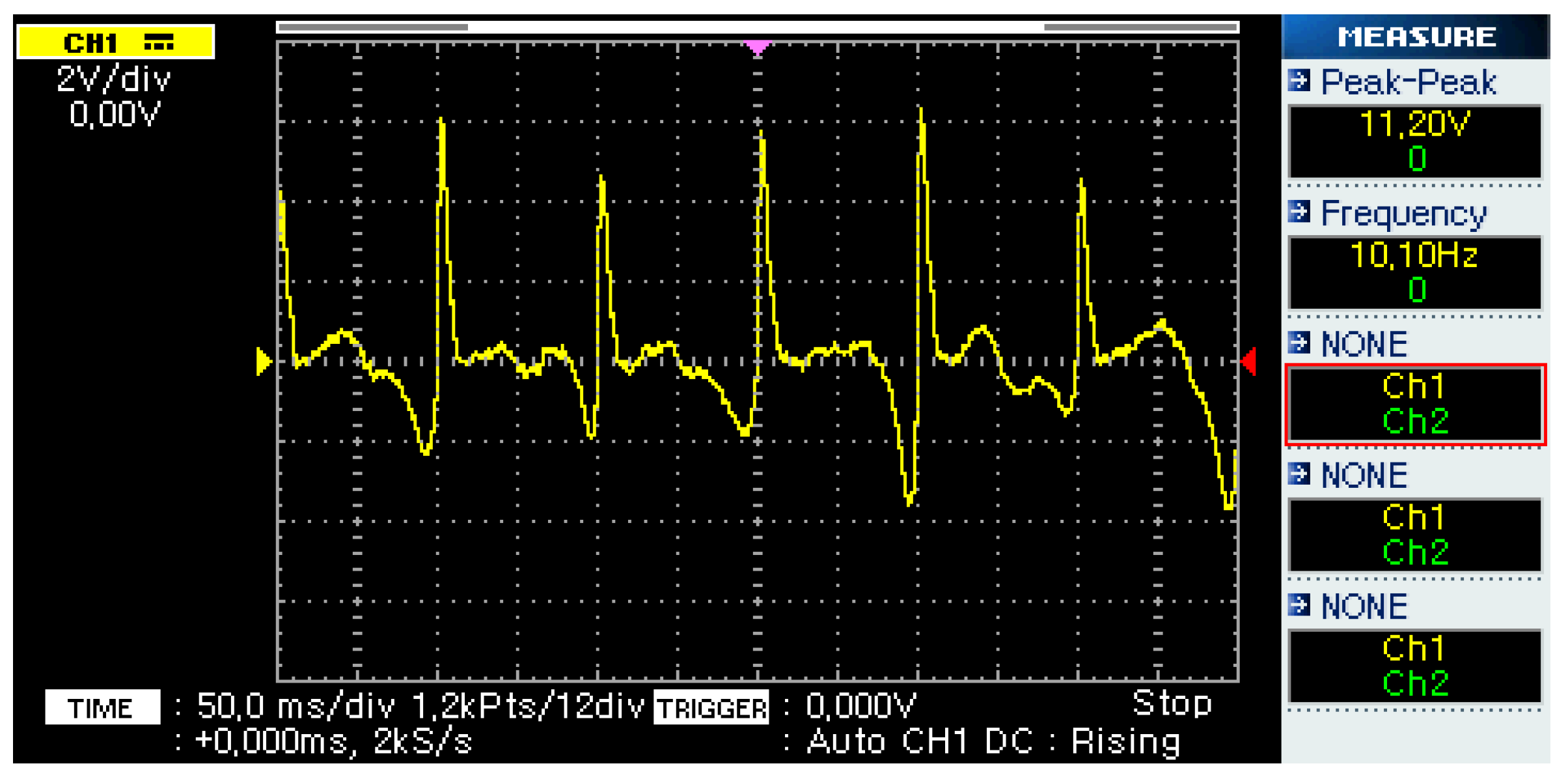 Micromachines 14 00028 g007
