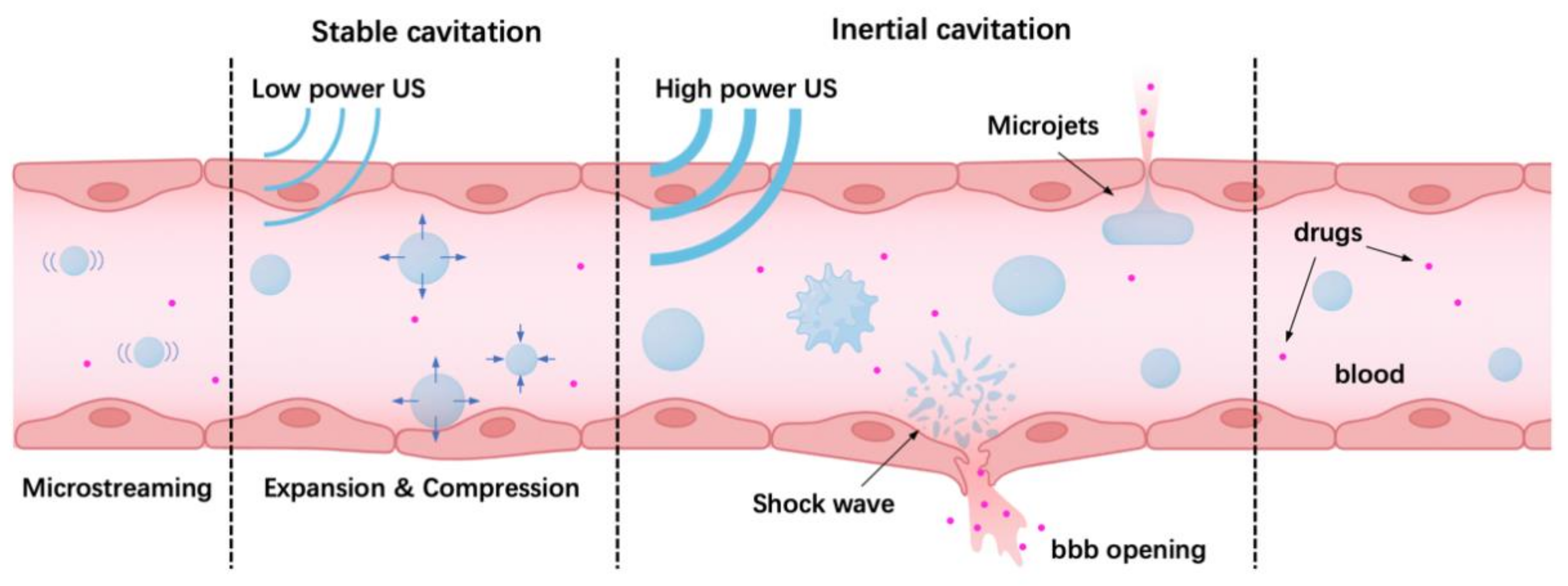 Micromachines 14 00112 g006
