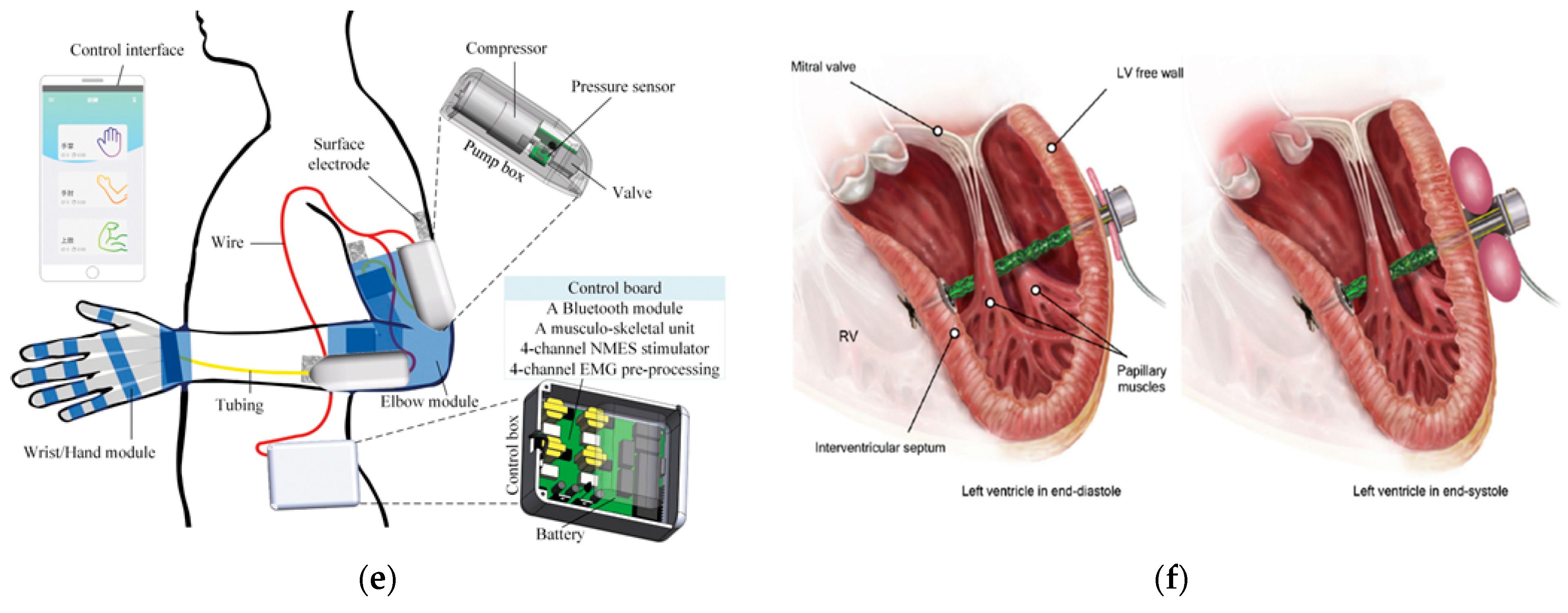 Micromachines 14 00359 g005b Micromachines 14 00359 g005b