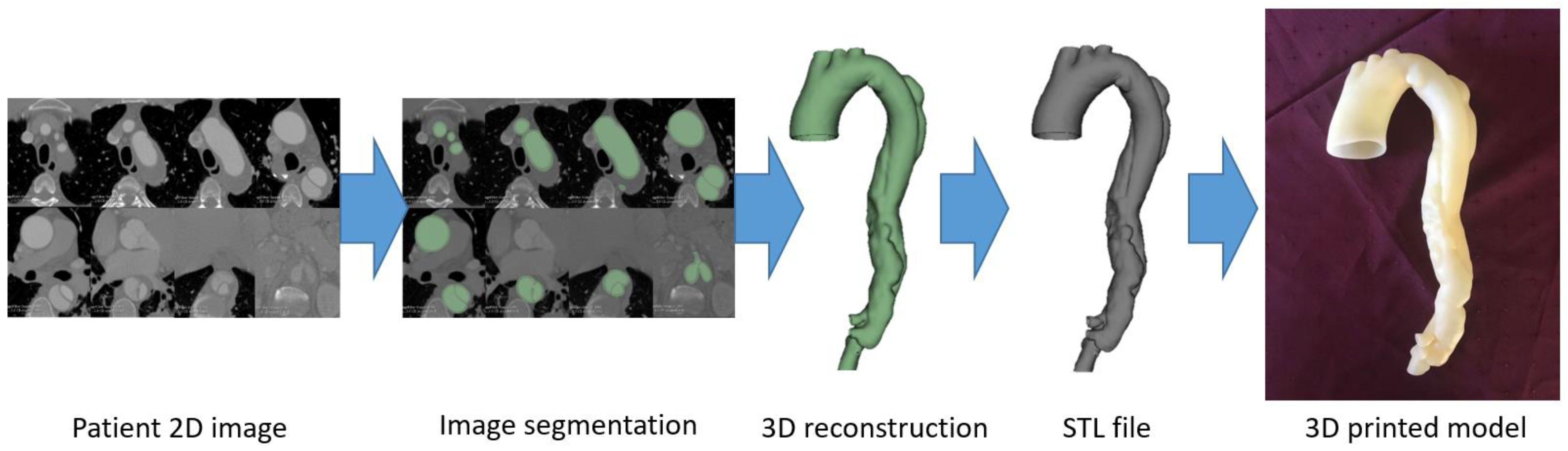 Micromachines 14 00464 g003