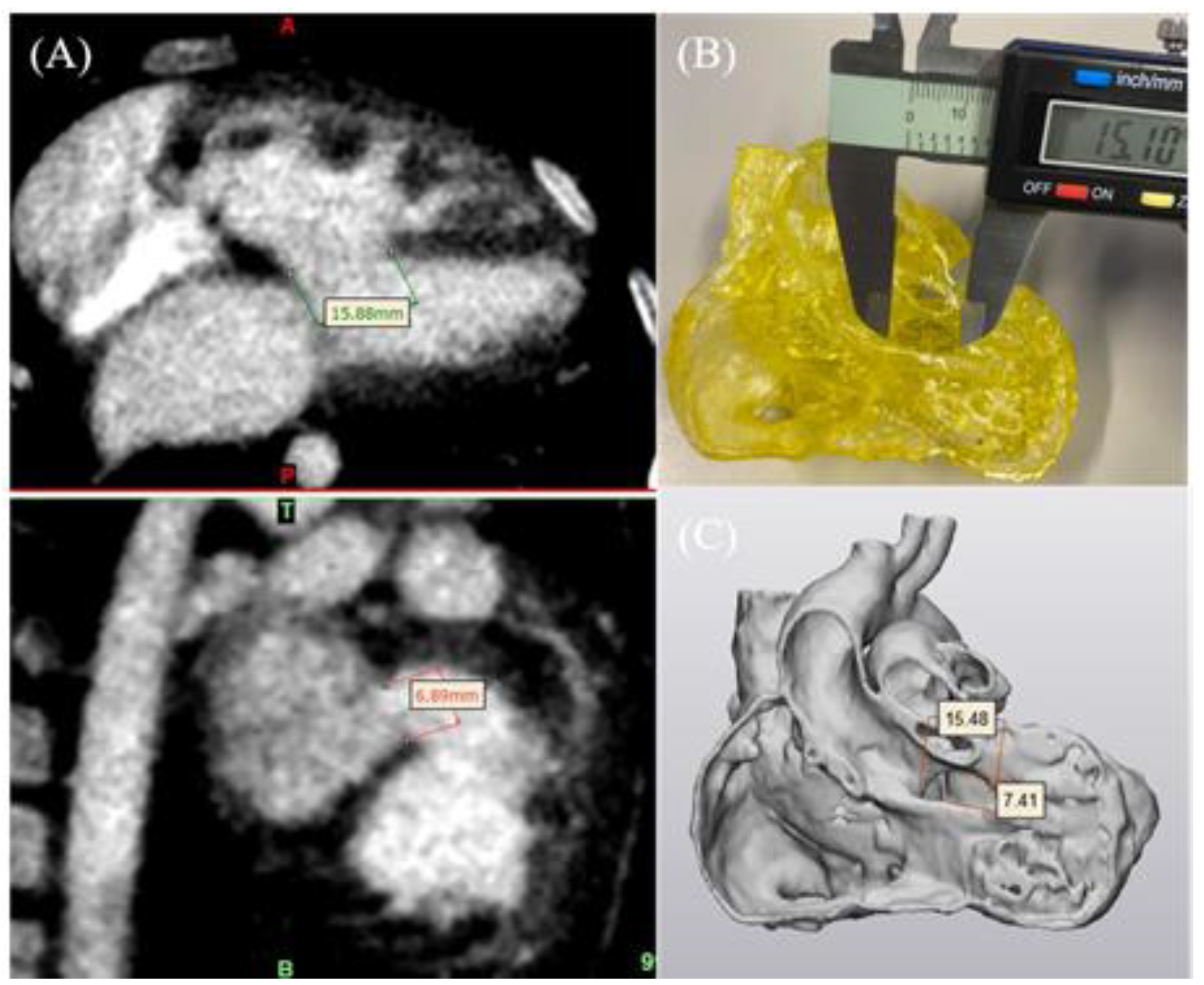 Micromachines 14 00464 g004