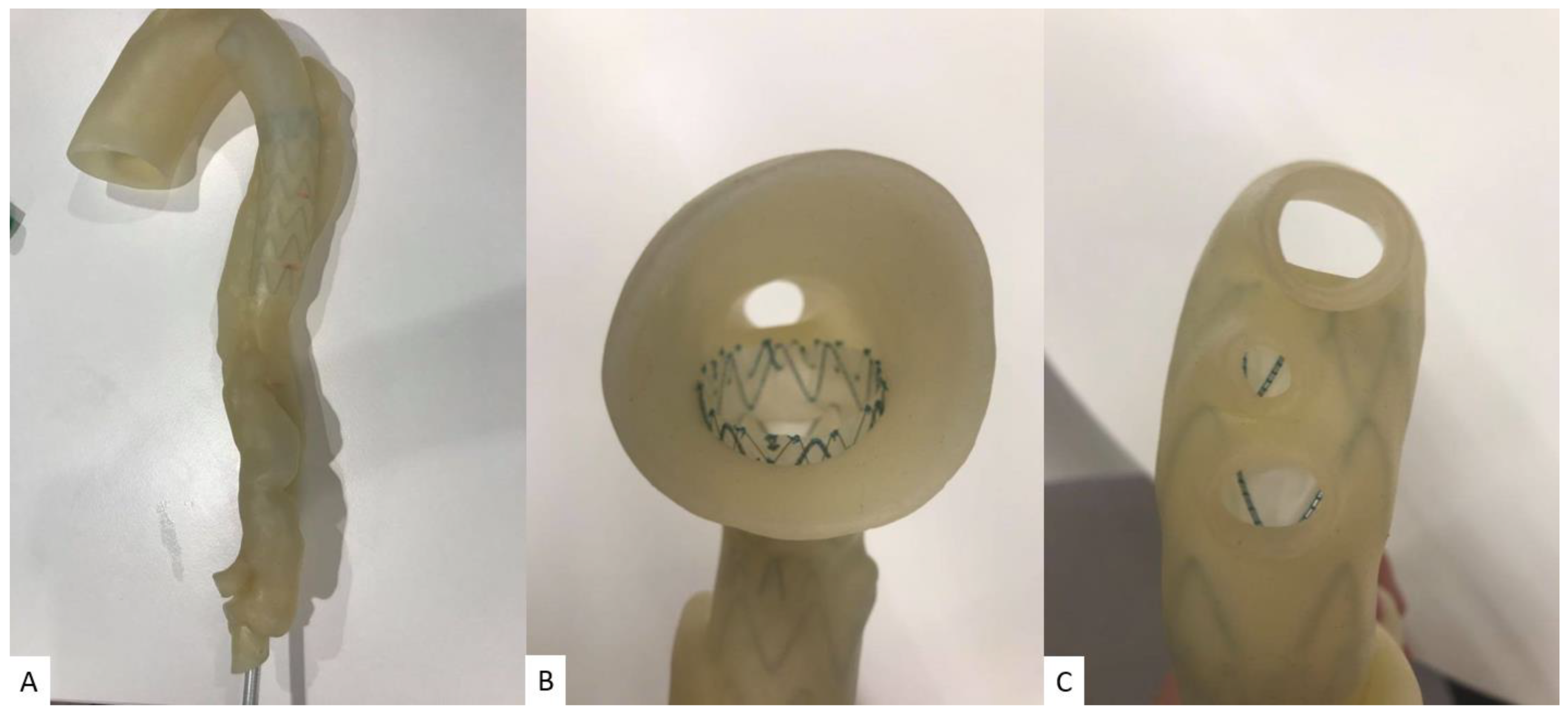 Micromachines 14 00464 g014