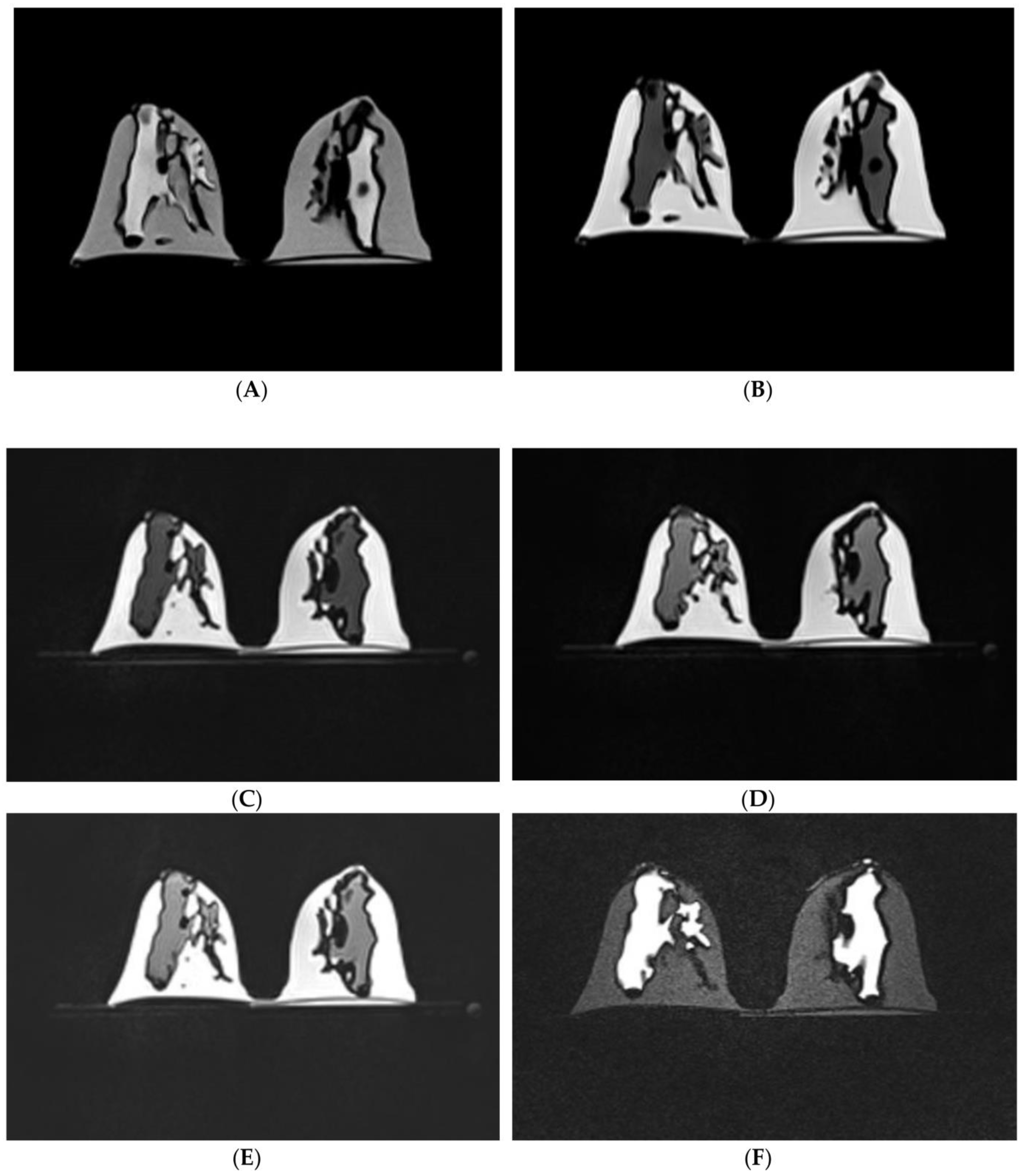 Micromachines 14 00464 g017