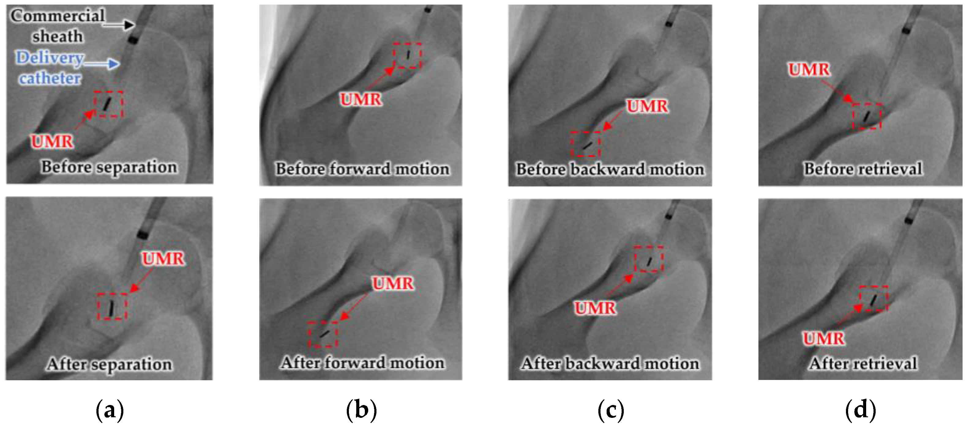 Micromachines 14 00724 g014
