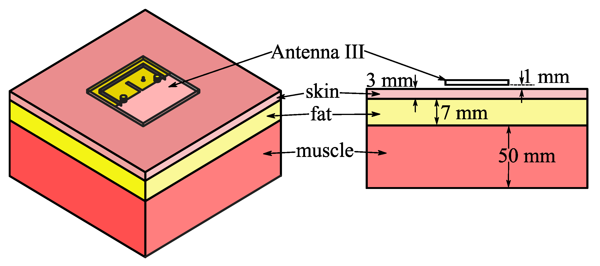 Micromachines 14 00934 g011