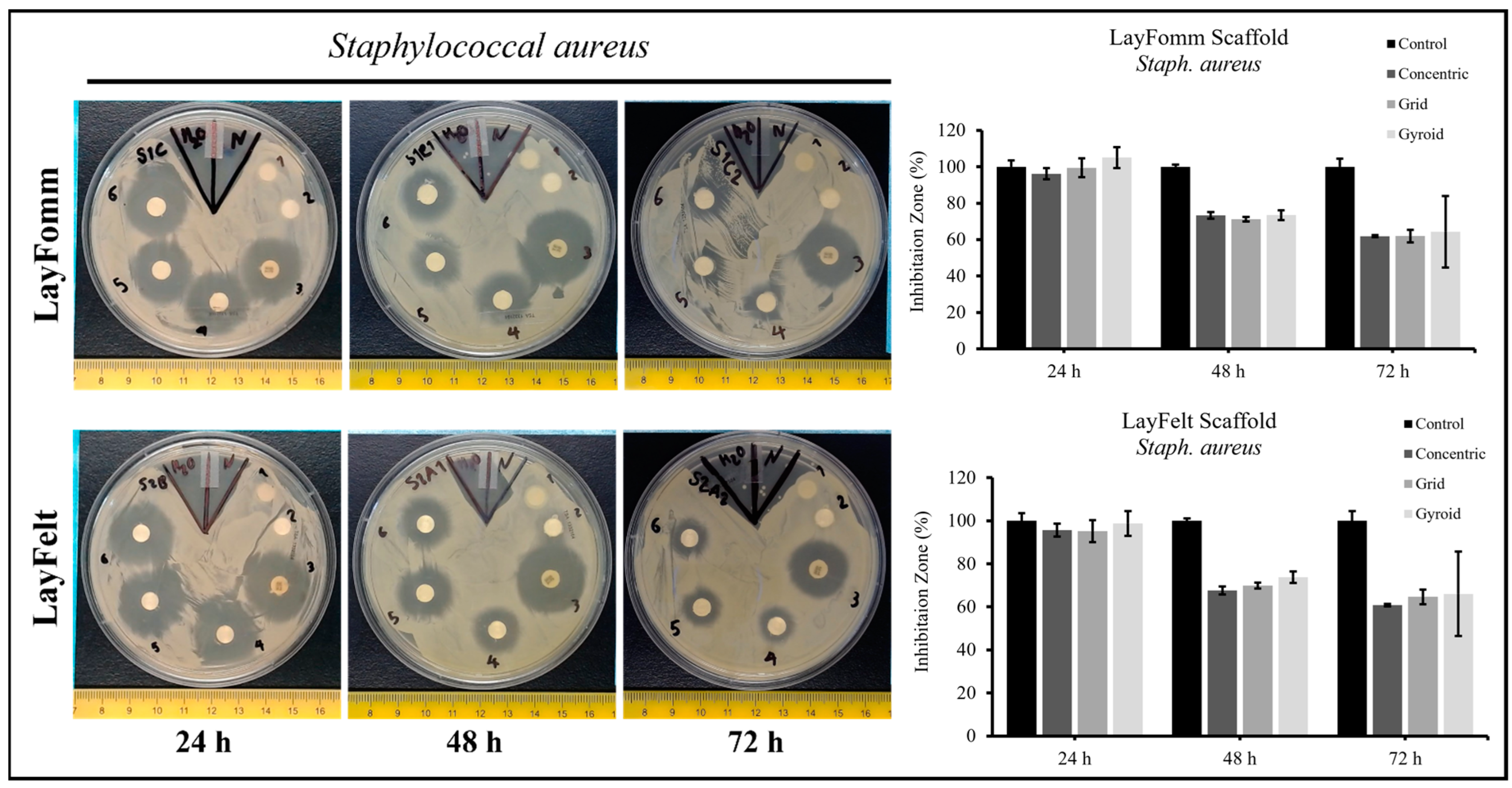 Micromachines 15 00083 g005