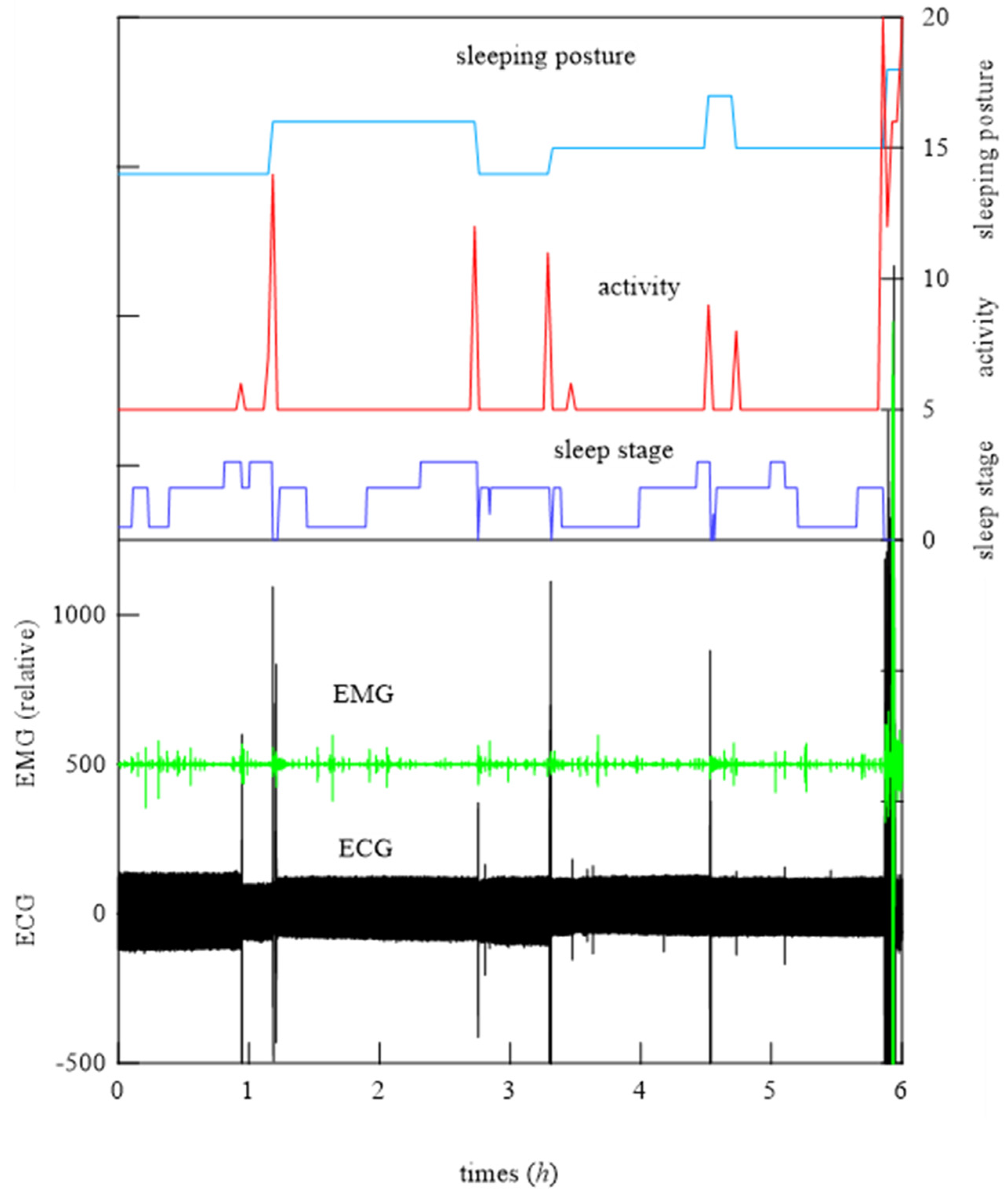 Micromachines 15 00086 g013