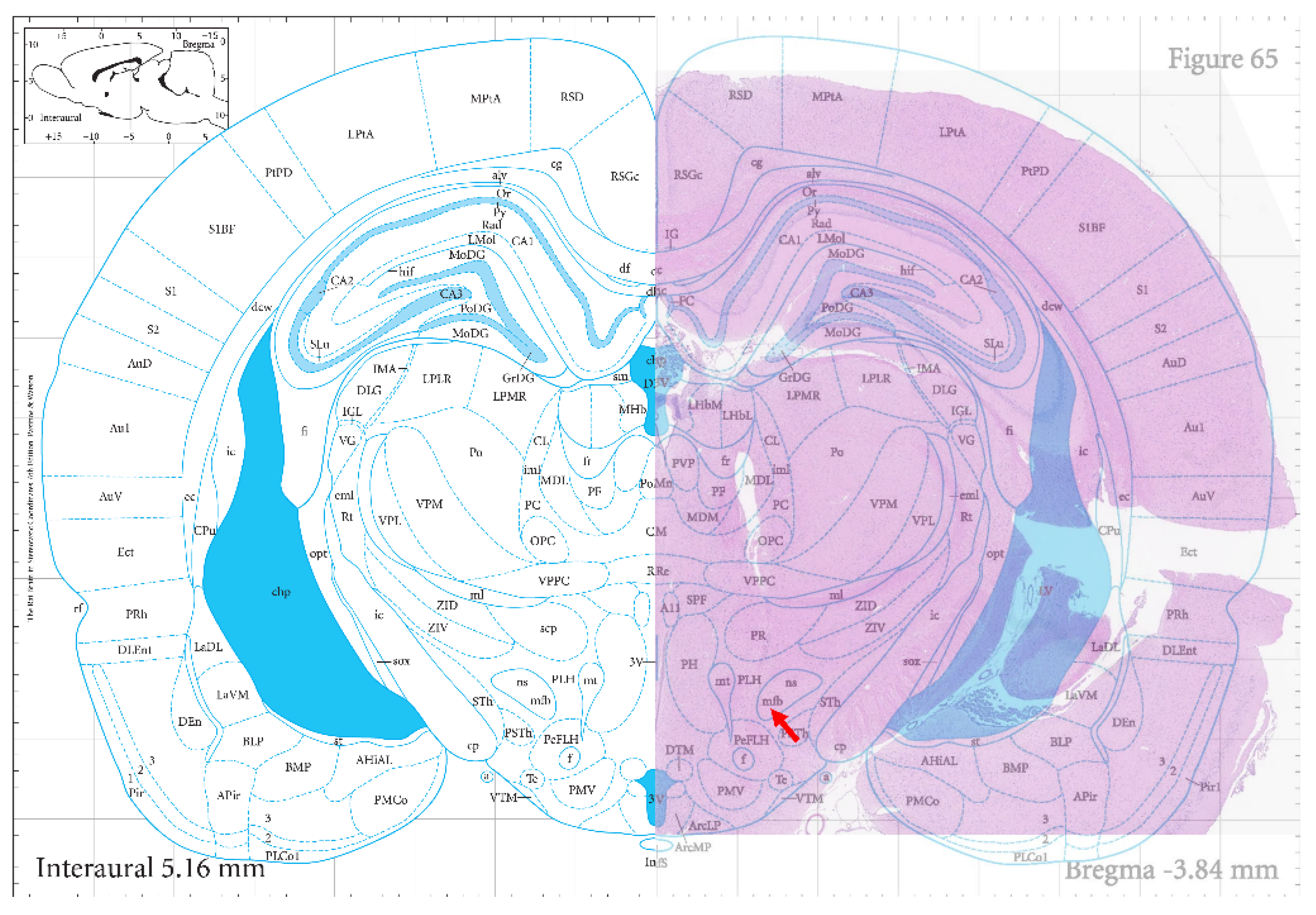 Micromachines 15 00587 g004