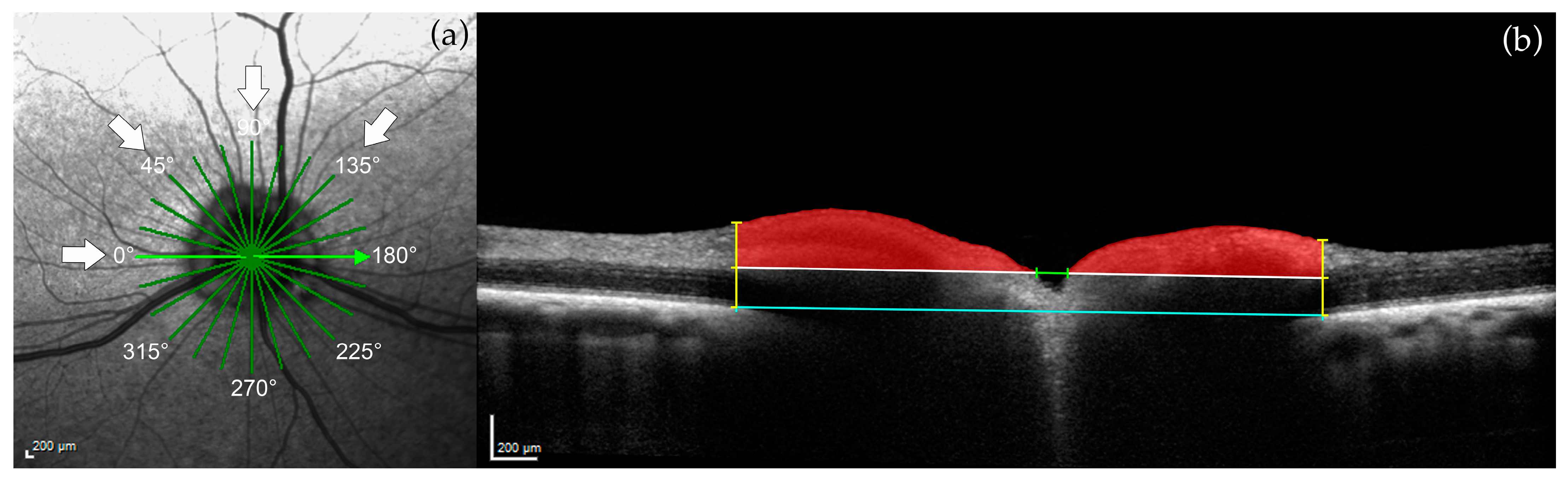 Micromachines 15 00780 g003