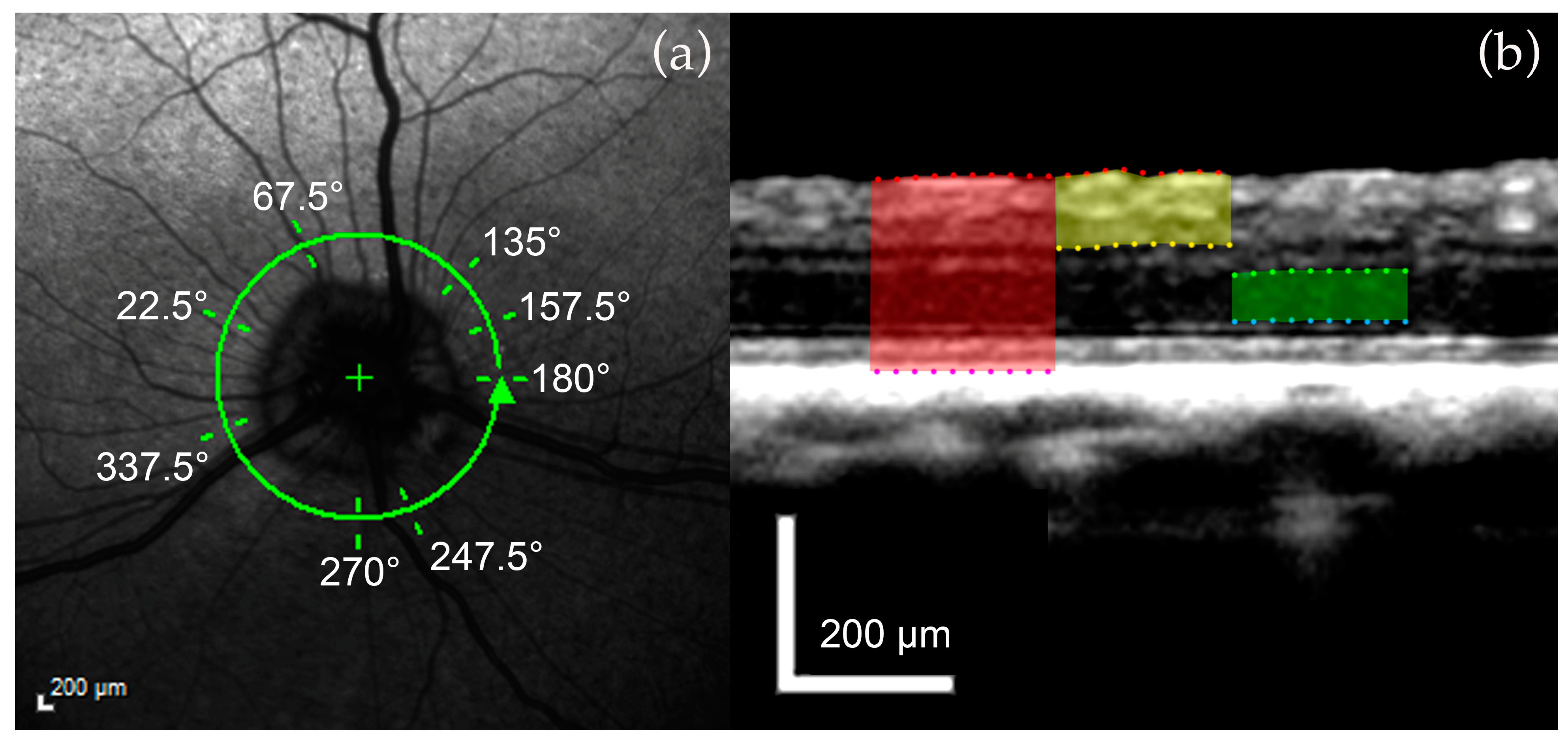 Micromachines 15 00780 g004