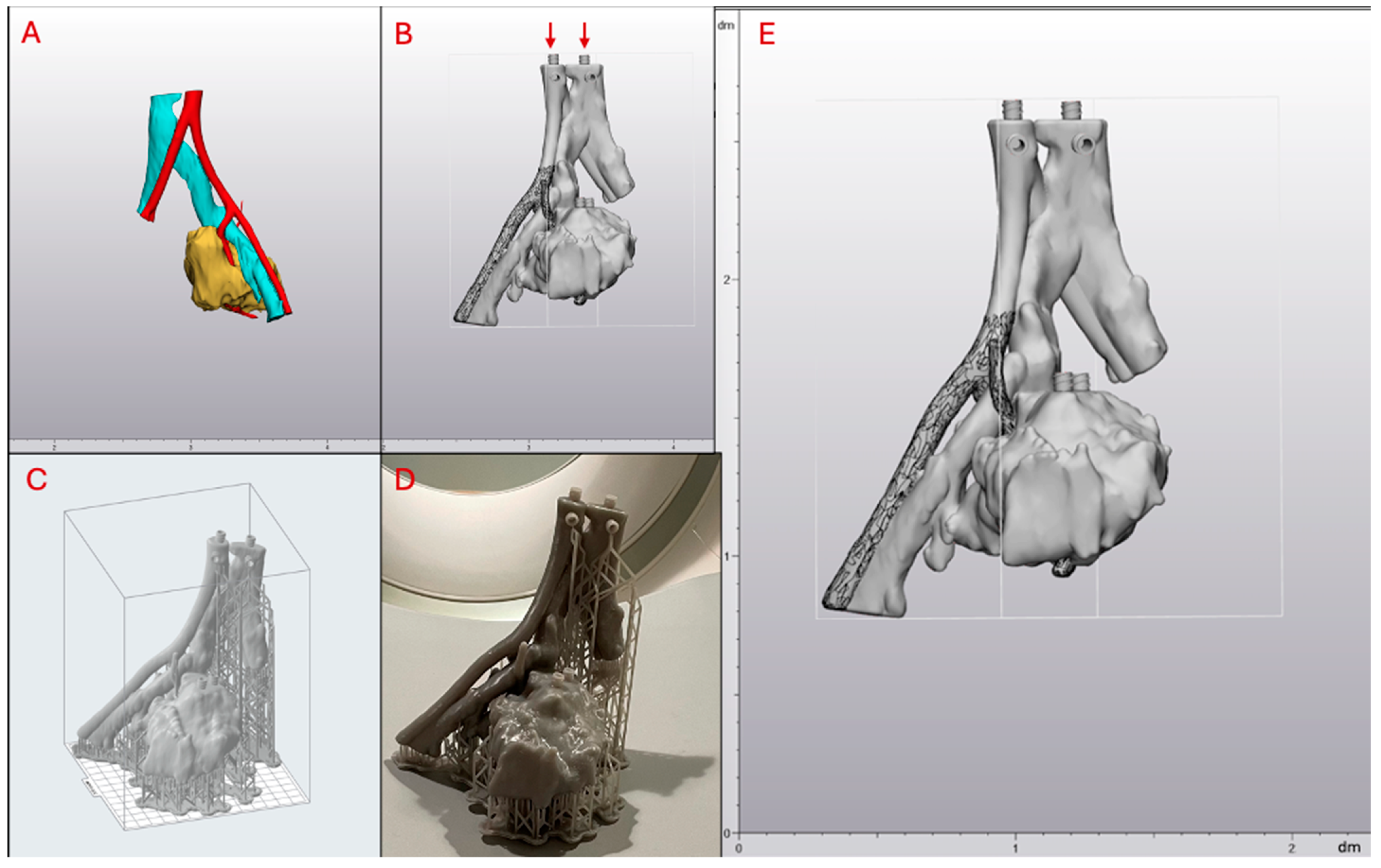 Micromachines 15 00992 g002