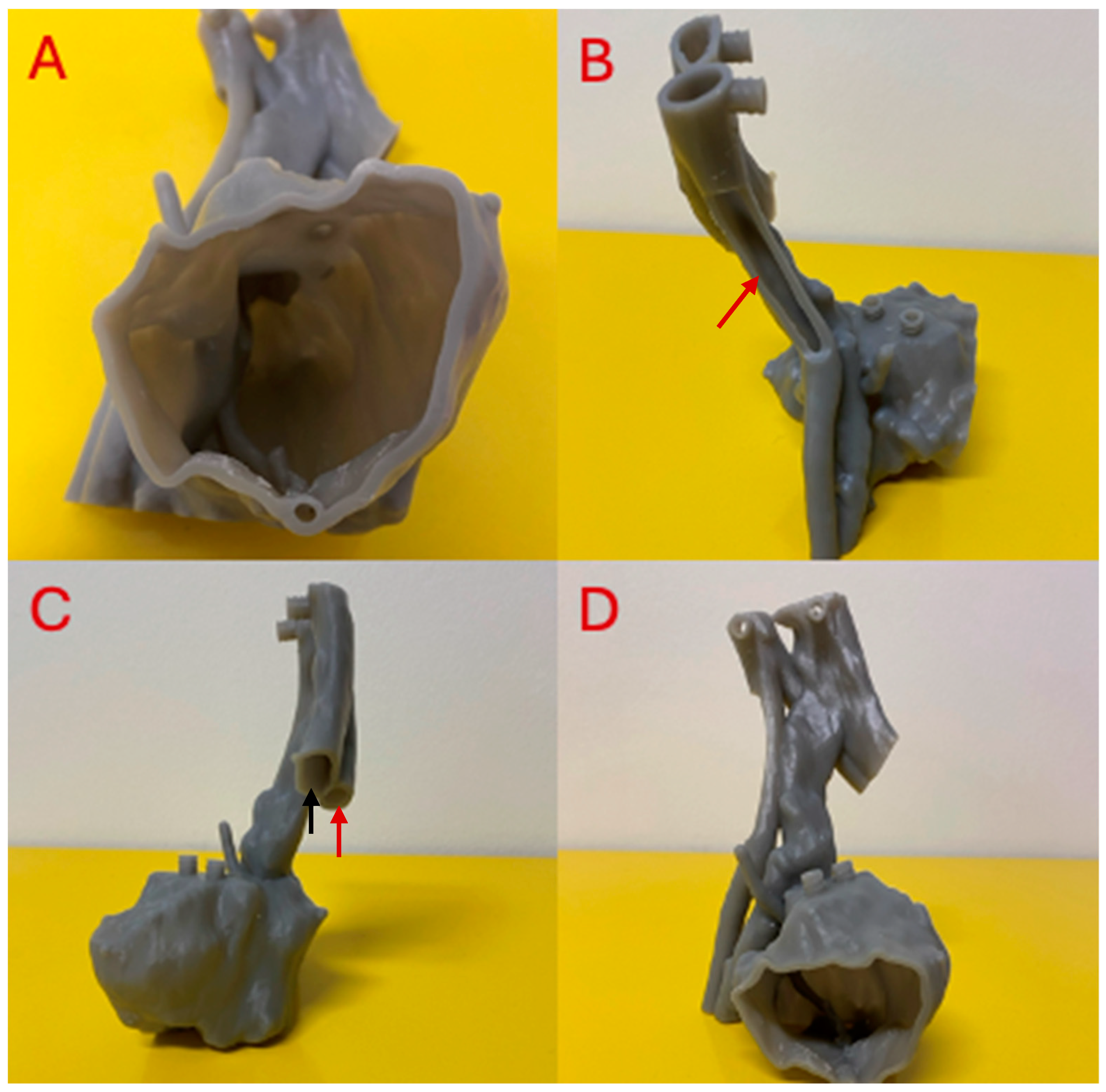 Micromachines 15 00992 g003