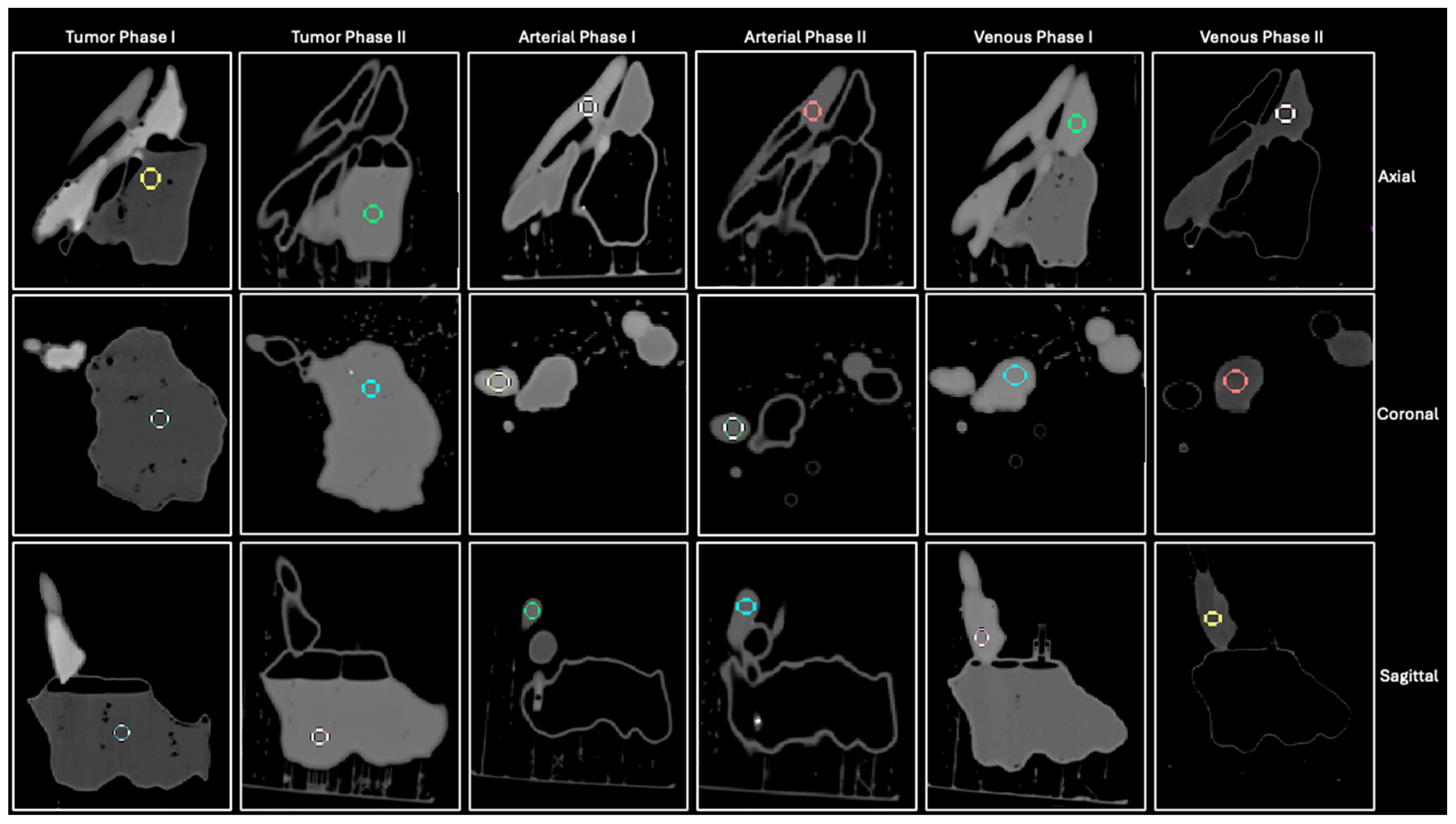 Micromachines 15 00992 g004