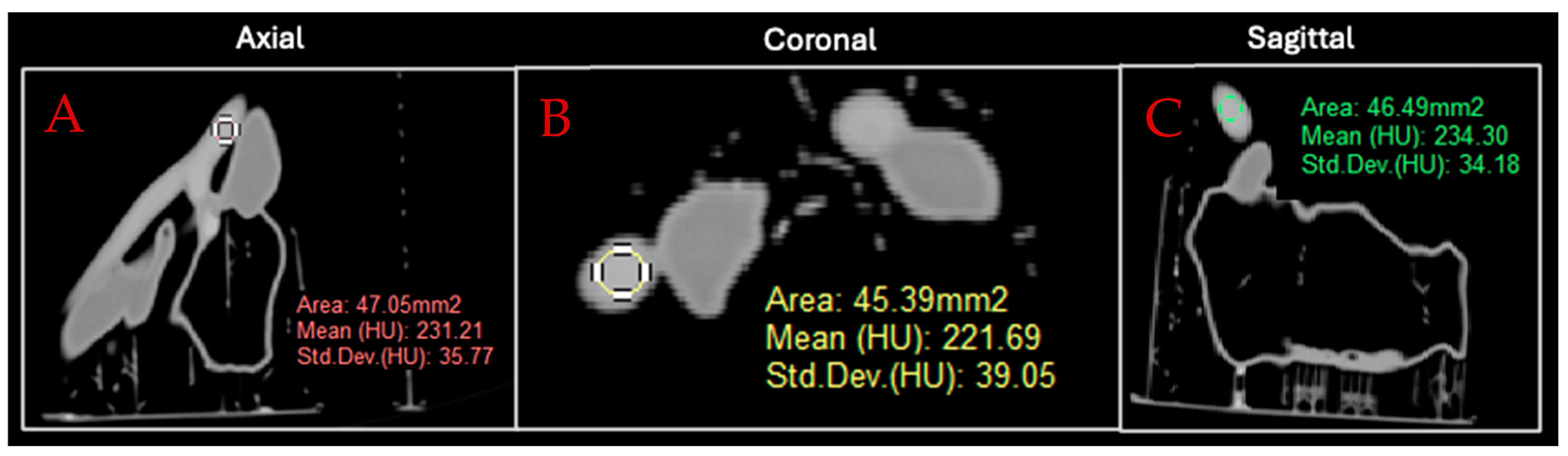 Micromachines 15 00992 g005