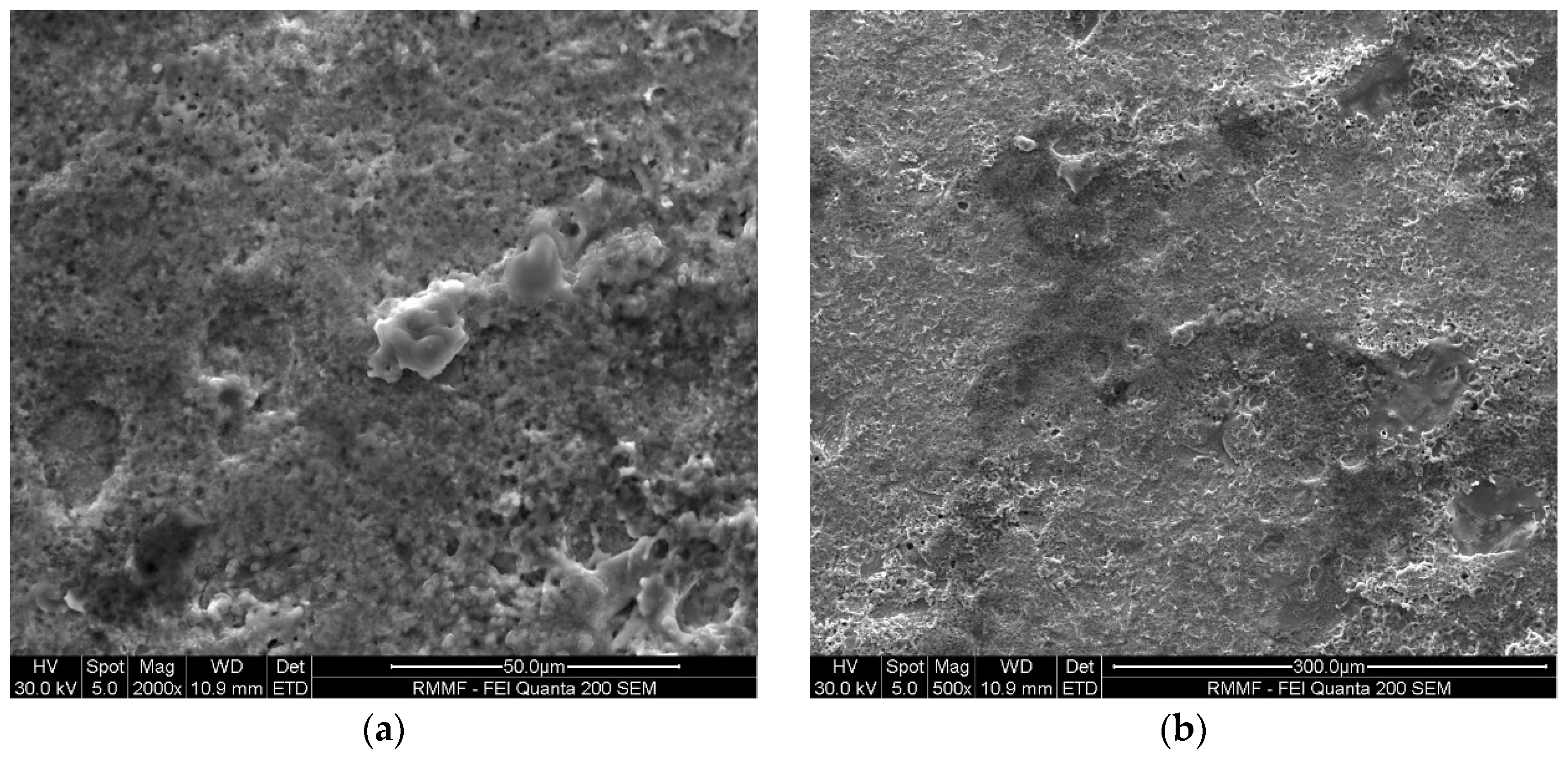 Micromachines 16 00147 g011