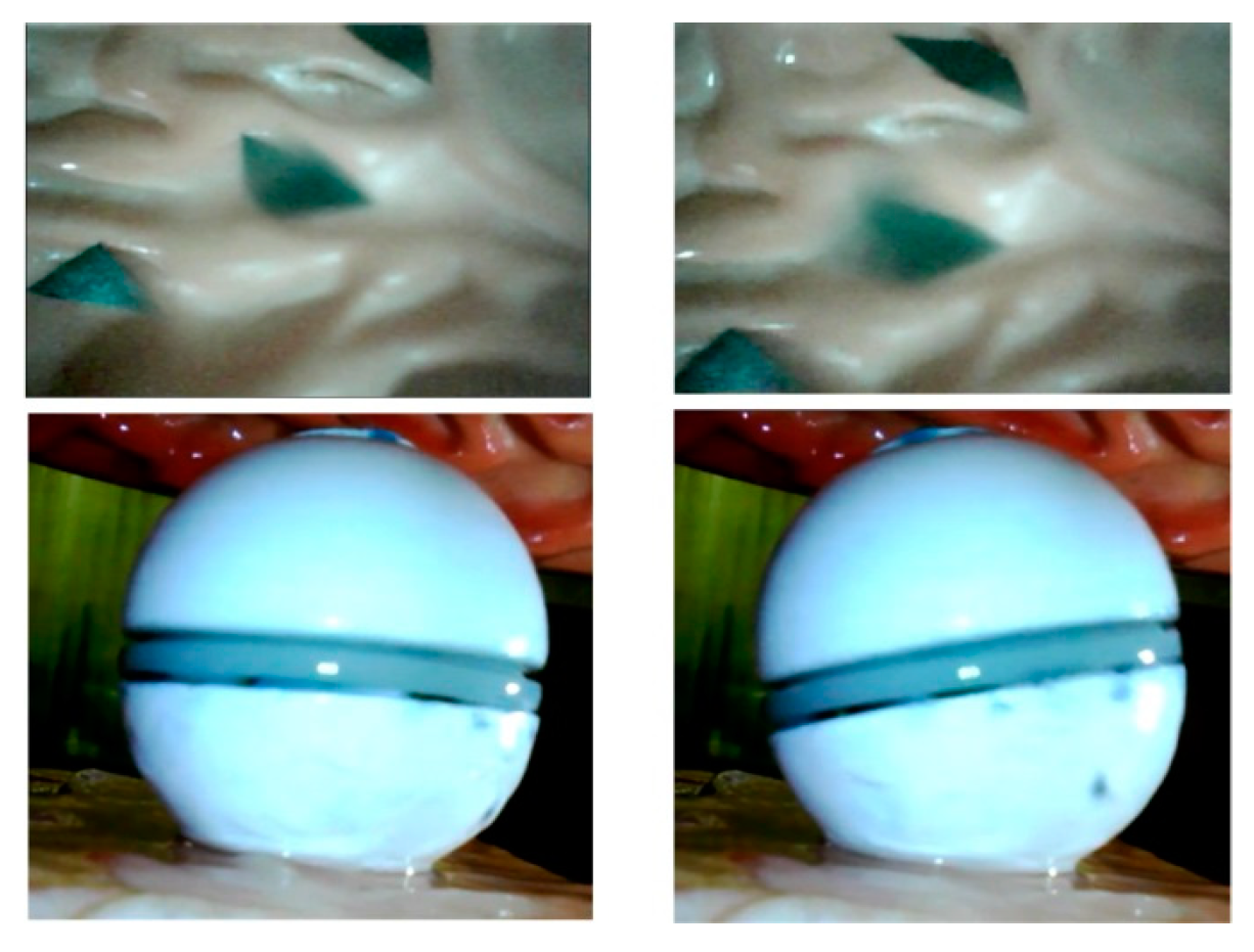 Micromachines 16 00485 g017